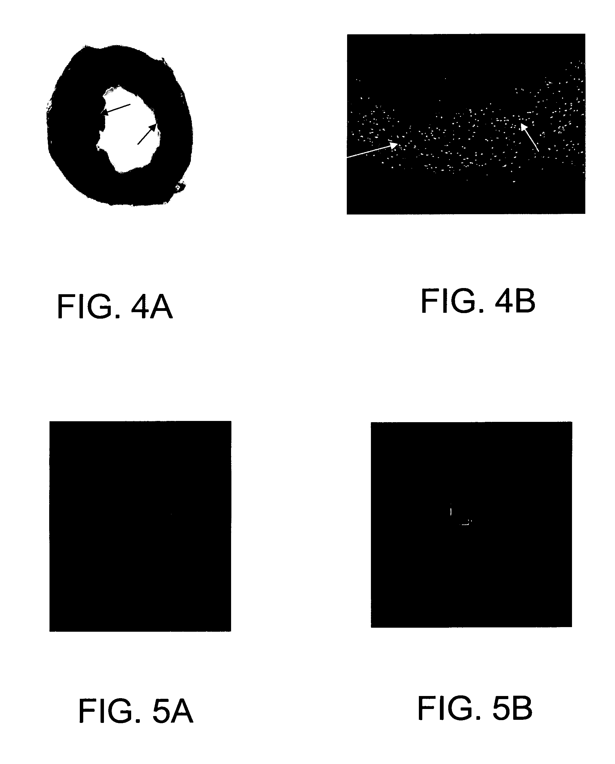 Composition and method for clusterin-mediated stem cell therapy for treatment of atherosclerosis and heart failure