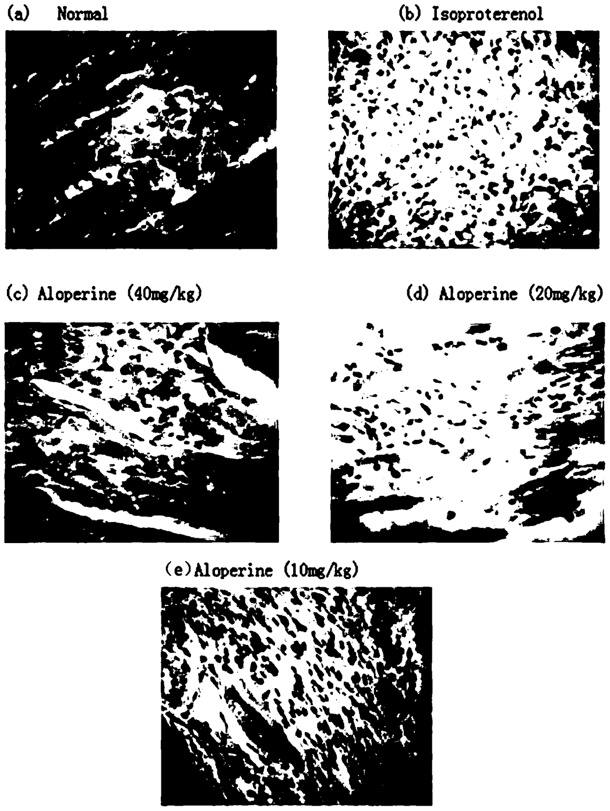 Application of aloperine in the preparation of drugs for treating myocardial hypertrophy