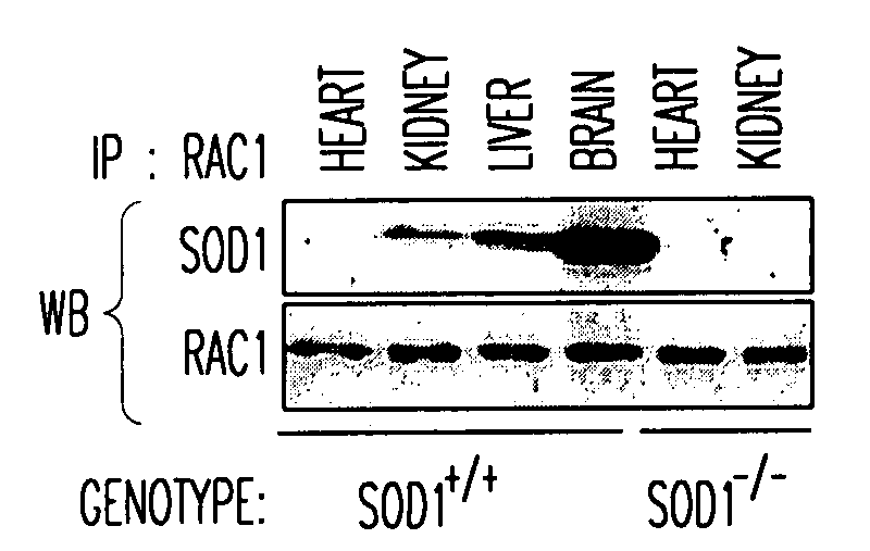 Method of identifying compounds useful to treat neuronal degenerative diseases