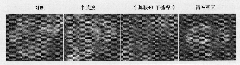 Application of cysteamine in preparing medicine for treating cancer