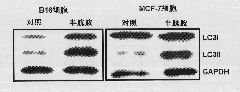 Application of cysteamine in preparing medicine for treating cancer