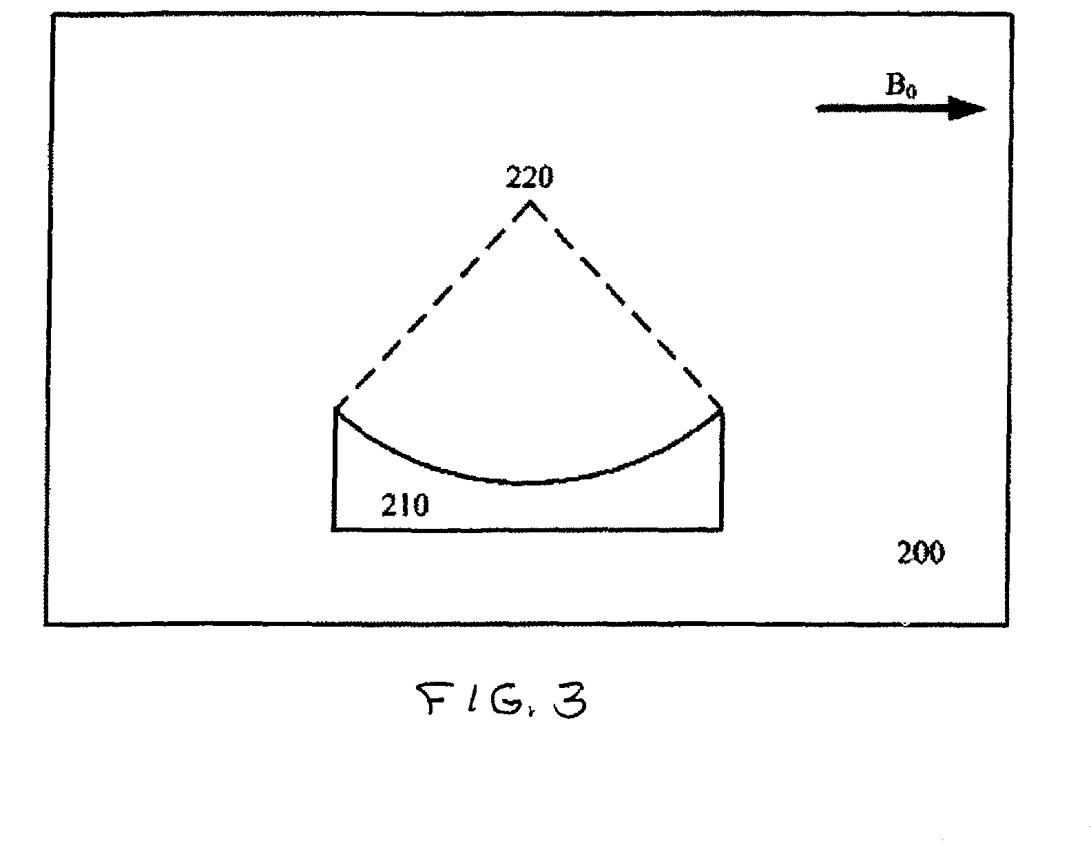 Magnetic resonance thermometry method