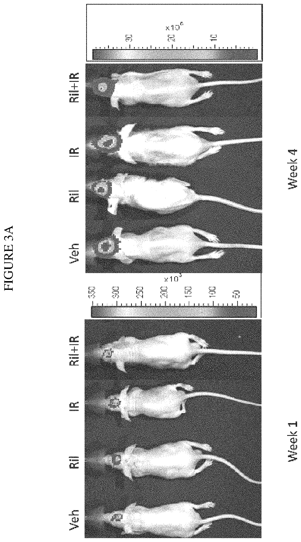 Combination therapy using riluzole to enhance tumor sensitivity to ionizing radiation