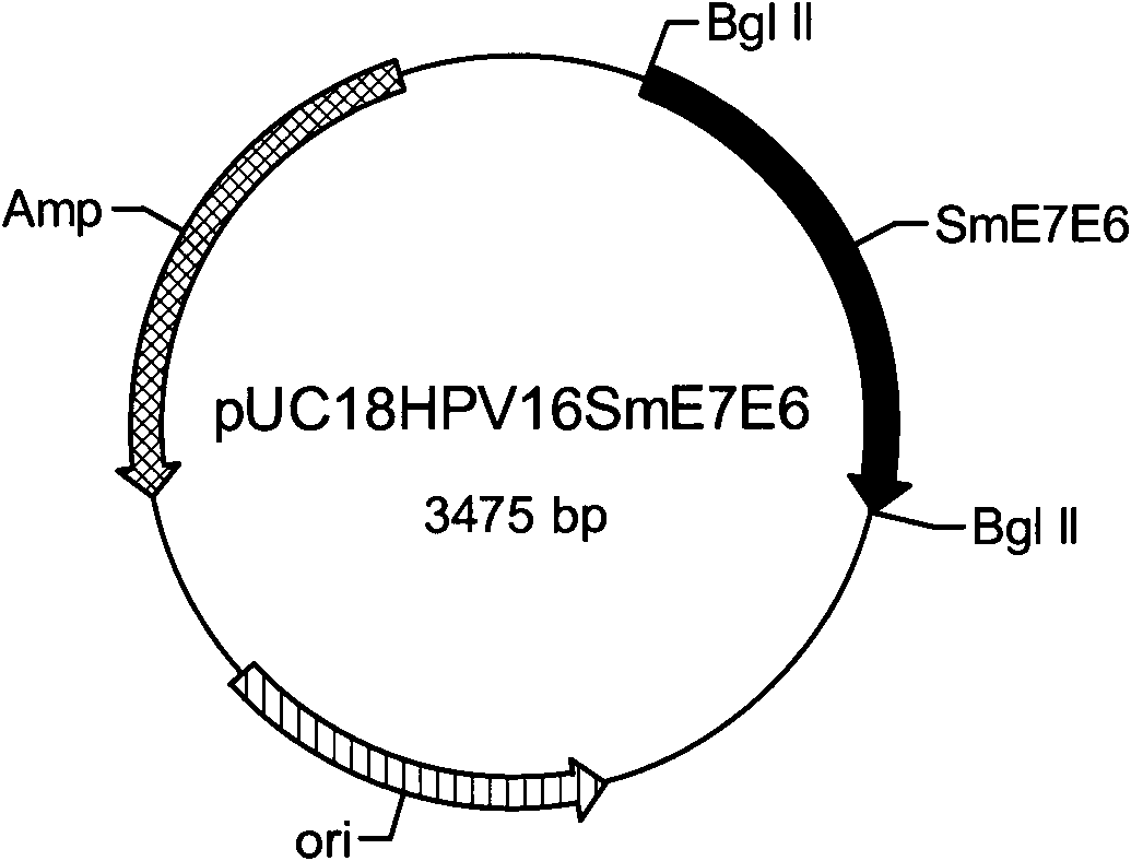 Gene, expression vector, expression method, expression cell and application of human papilloma virus (HPV) 16 E7E6 fusion protein