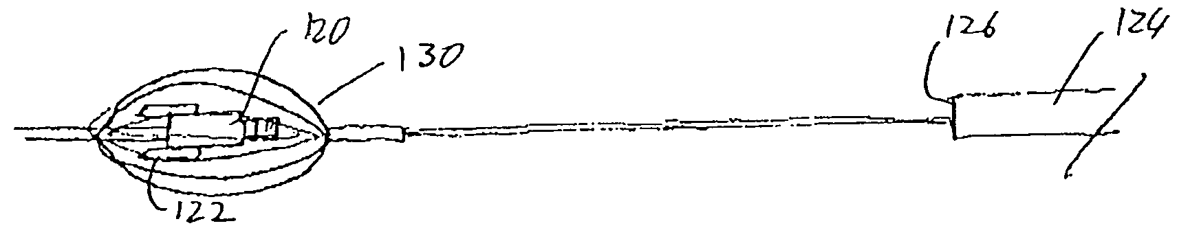 Intravascular devices, retrieval systems, and corresponding methods