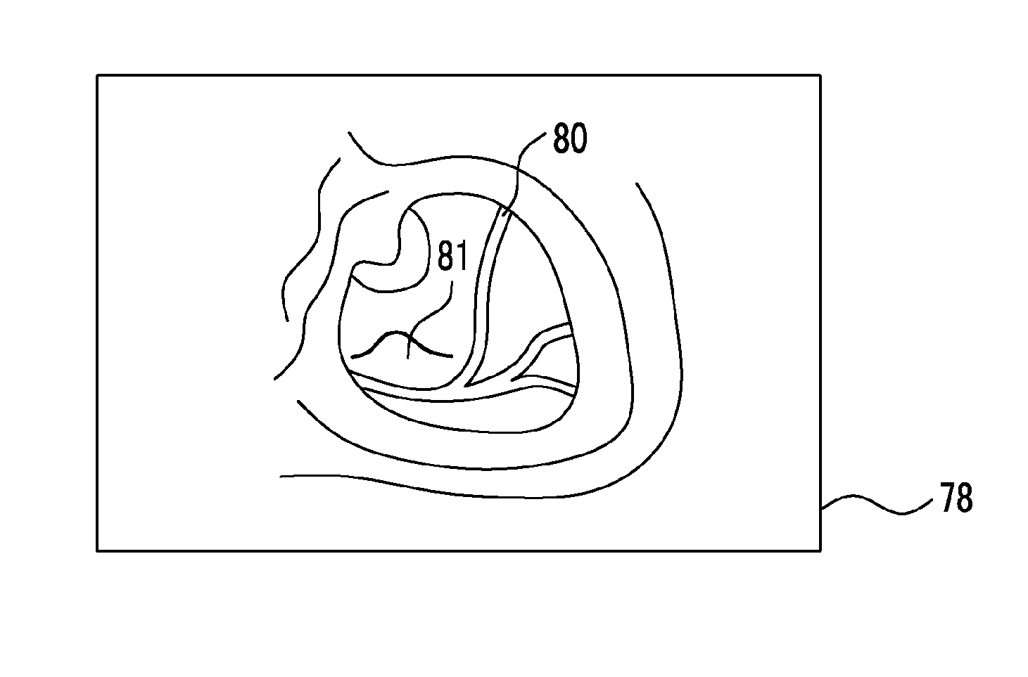 Endoscope system and image generation method