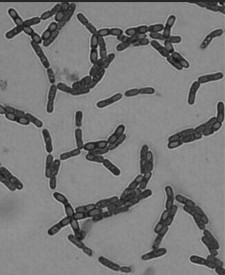 A Strain of Bacillus arborii j5 and Its Application