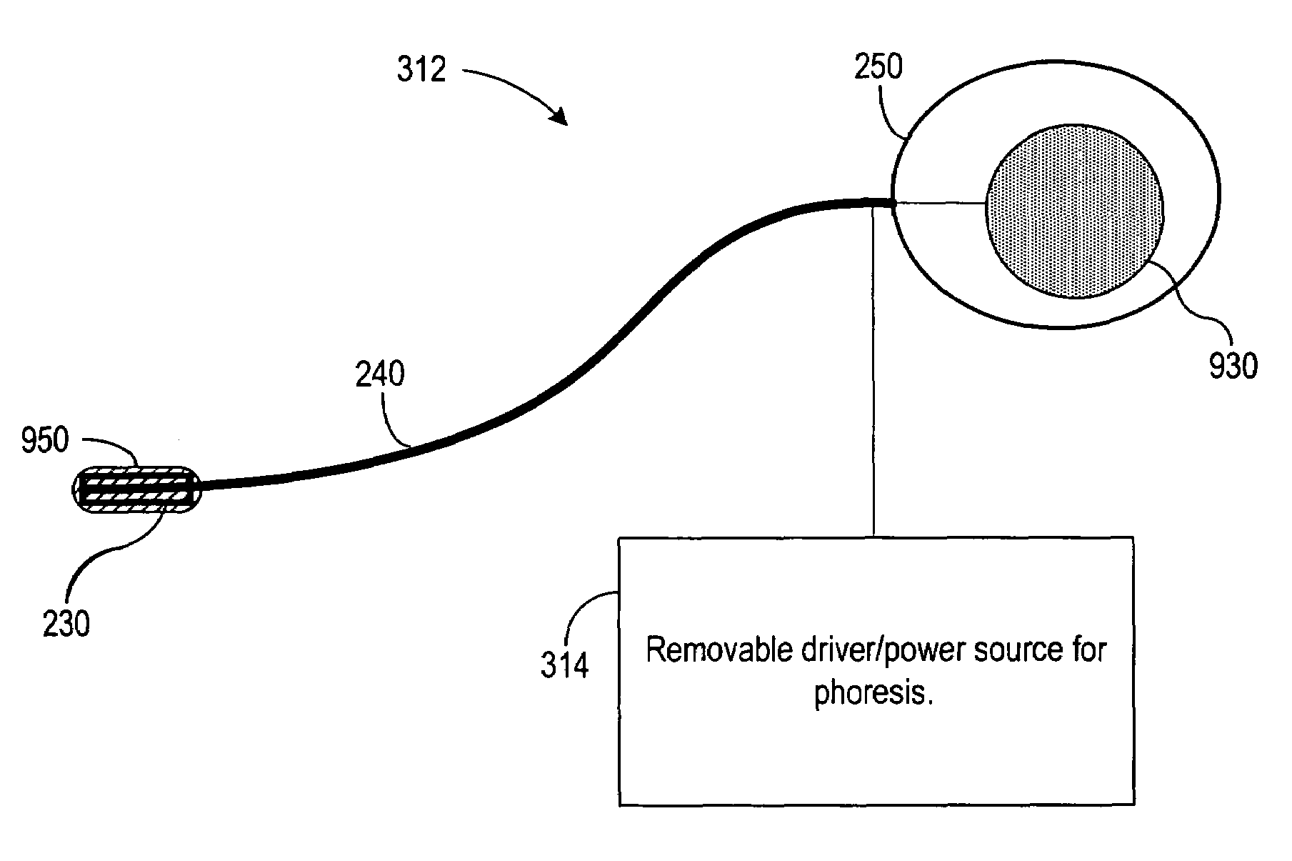 Subcutaneous electrode and lead with phoresis based pharmacological agent delivery