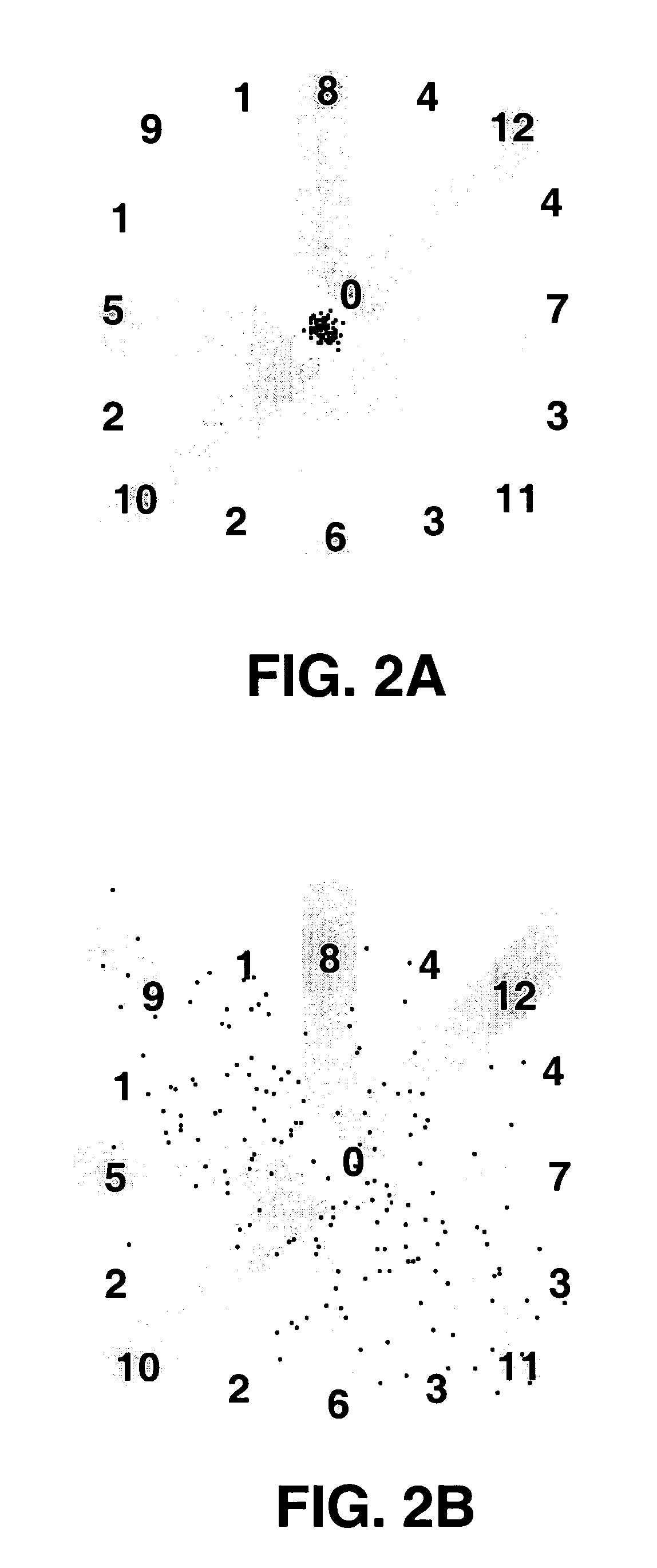 Method and apparatus for detection of tachyarrhythmia using cycle lengths