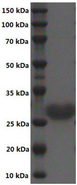 Short-chain dehydrogenase and gene thereof, recombinant expression vector, genetically engineered bacterium and application thereof in astaxanthin chiral intermediate synthesis