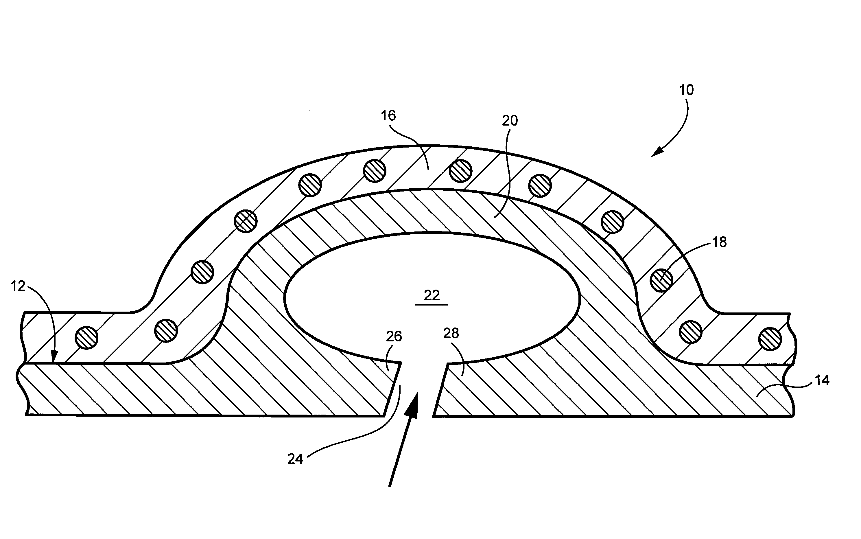 Bolt-on radial bleed manifold