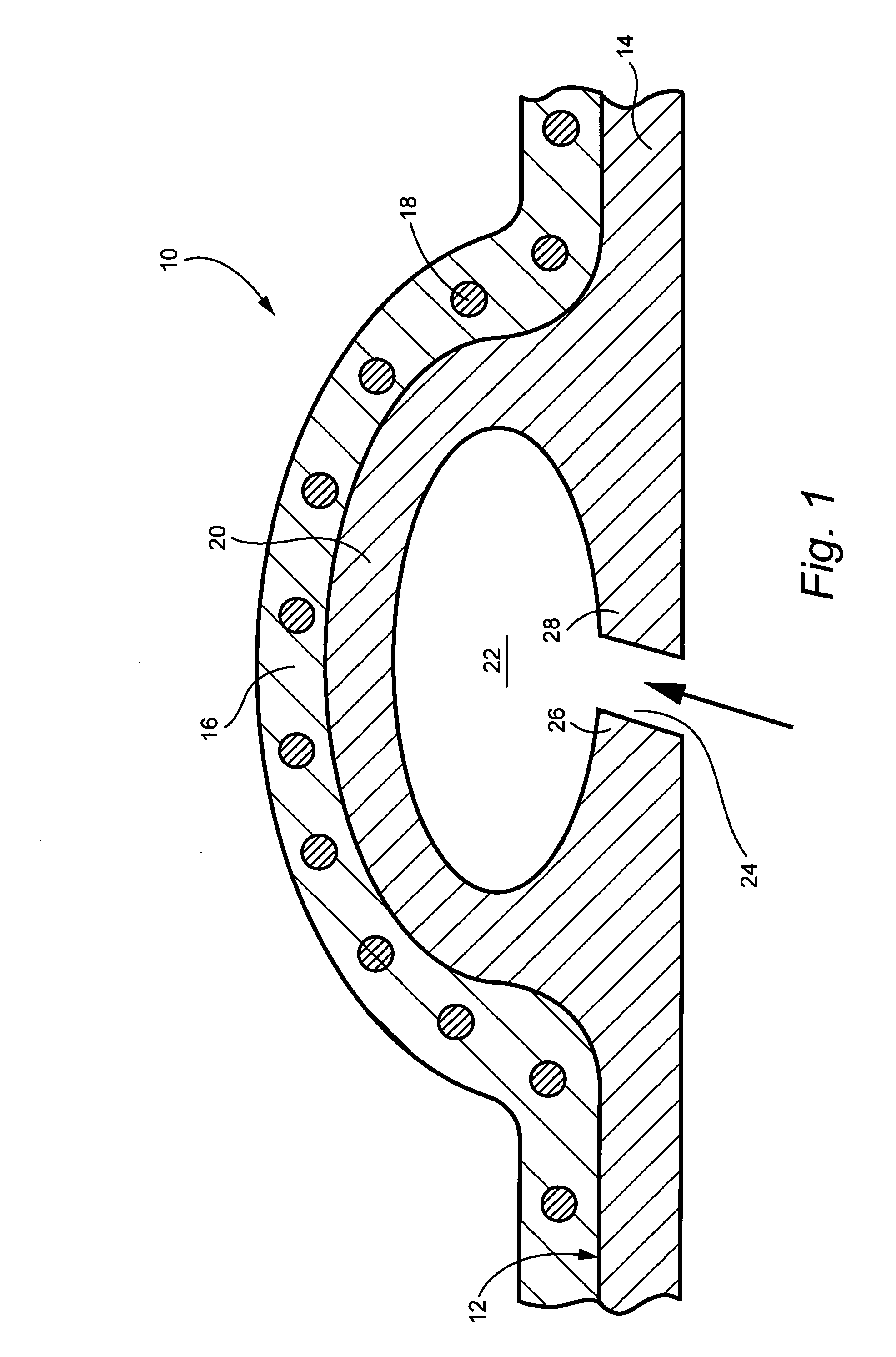 Bolt-on radial bleed manifold