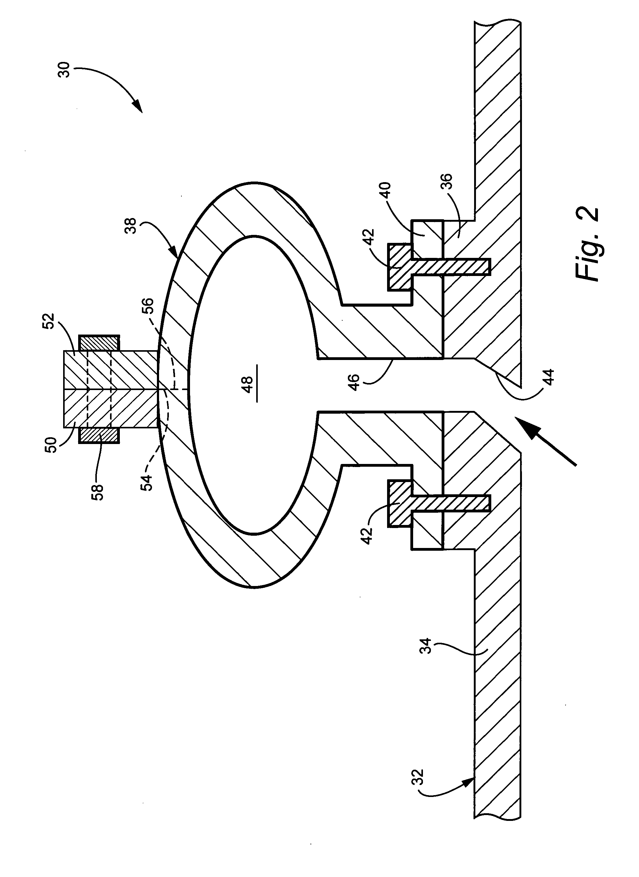 Bolt-on radial bleed manifold