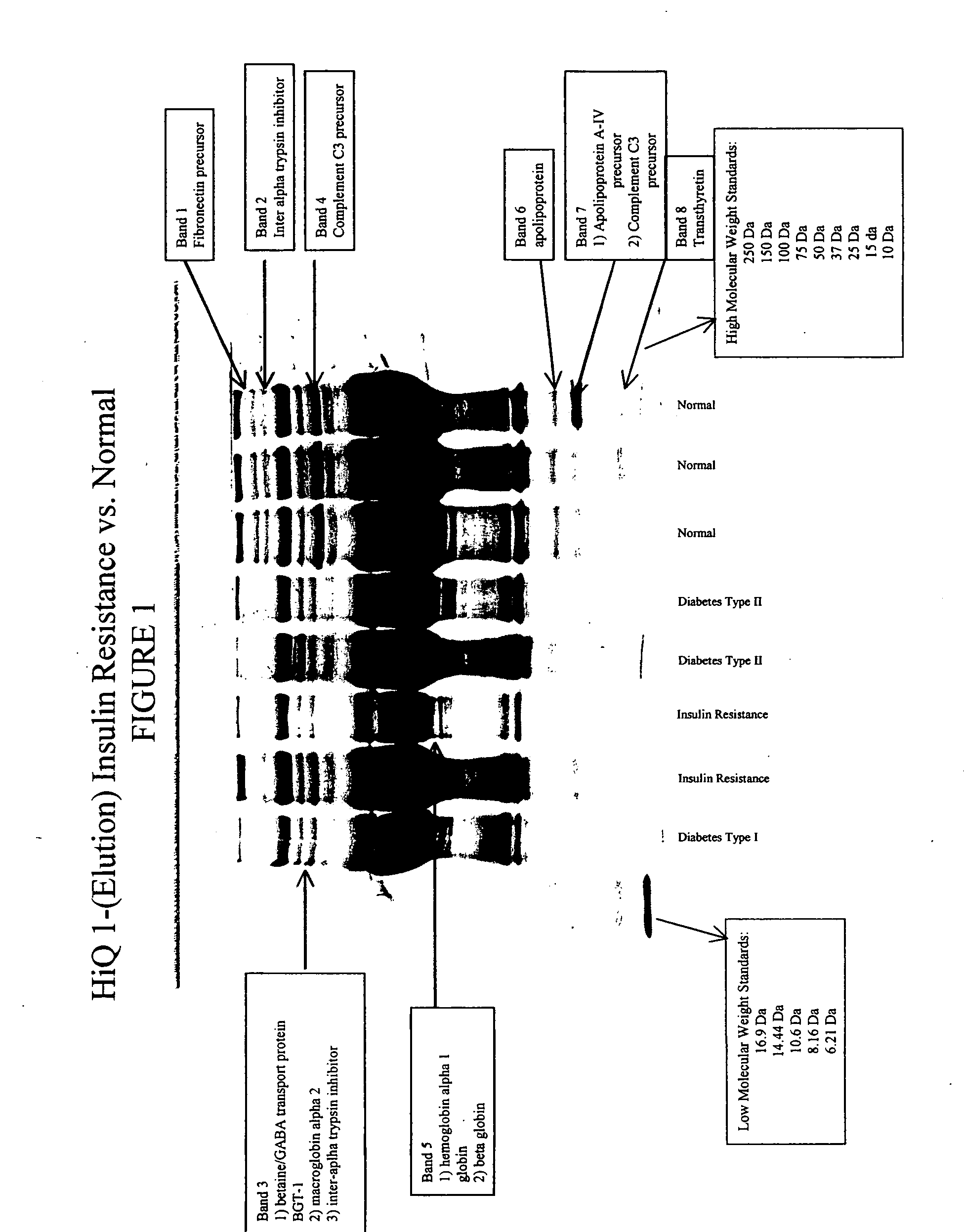 Apolipoprotein biopolymer markers indicative of insulin resistance