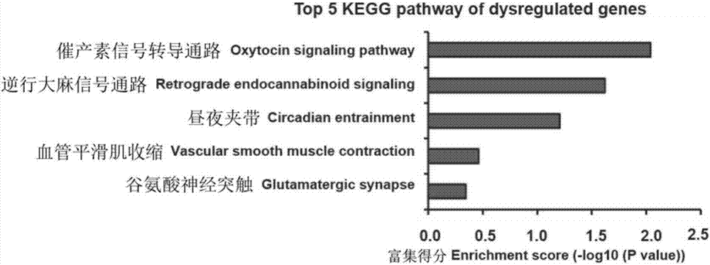 Marker associated with the diagnosis of malignant glioma and application thereof