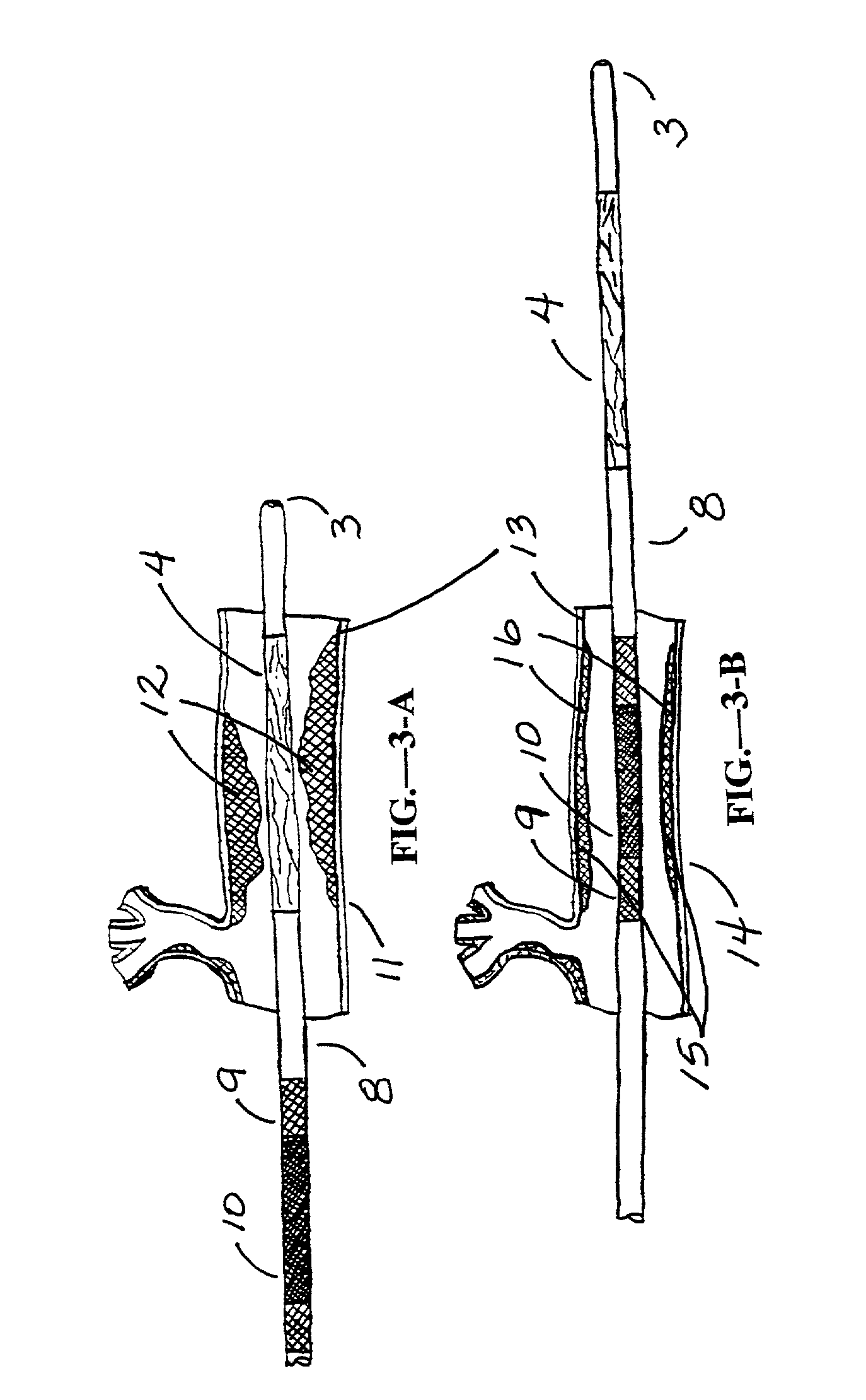 Dilating and support apparatus with disease inhibitors and methods for use