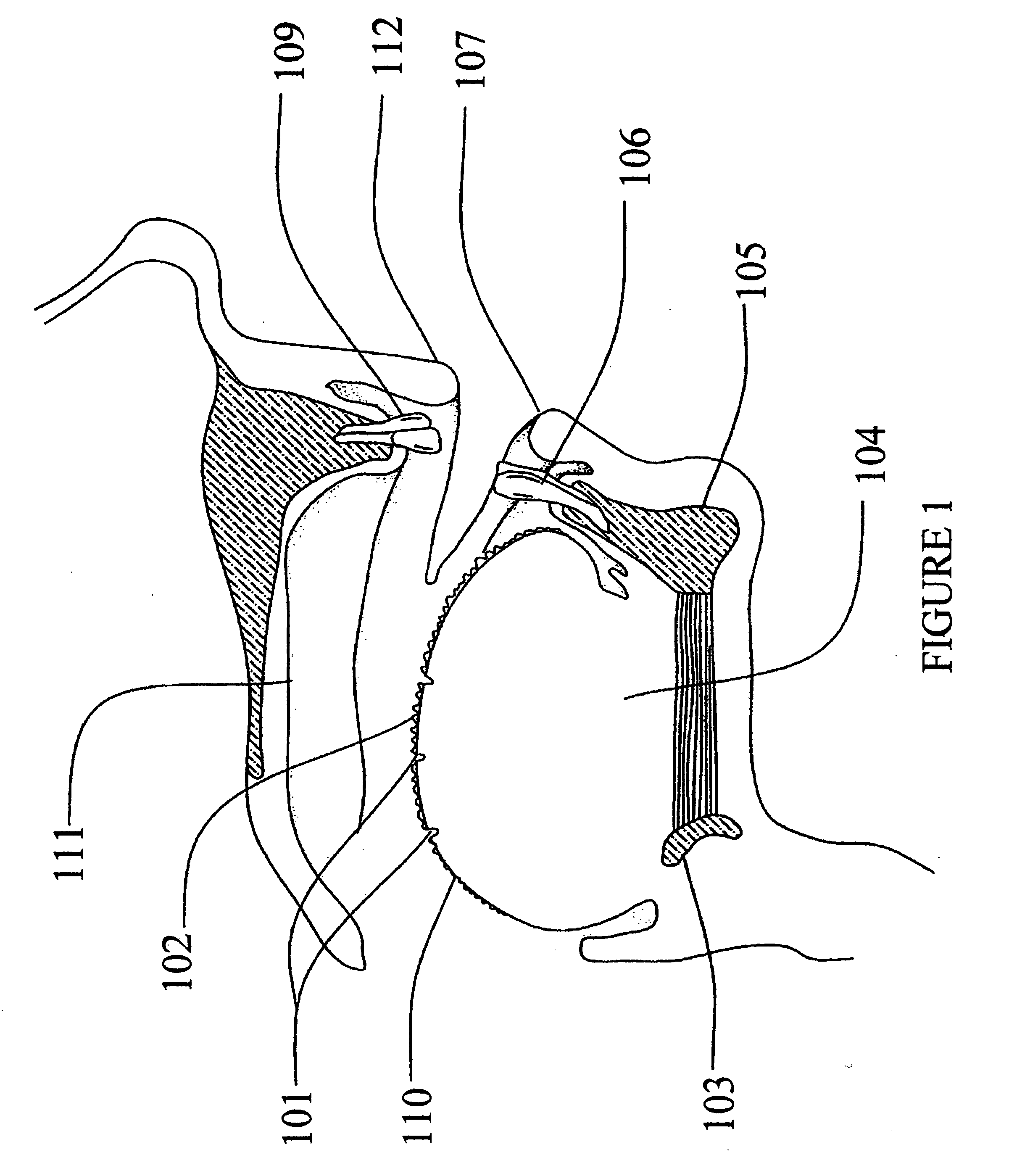 Tongue cleaning device