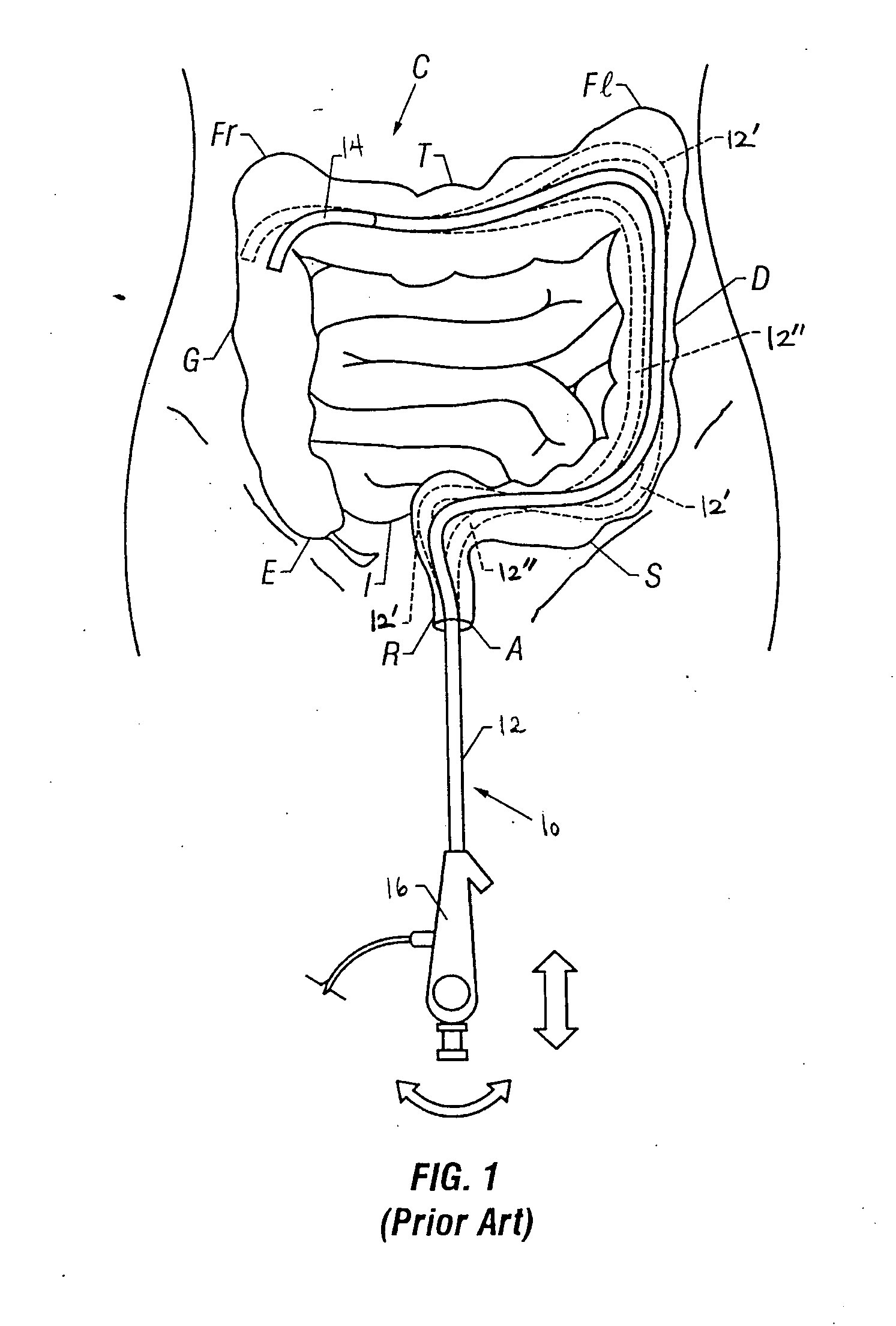 Method and apparatus for advancing an instrument along an arbitrary path