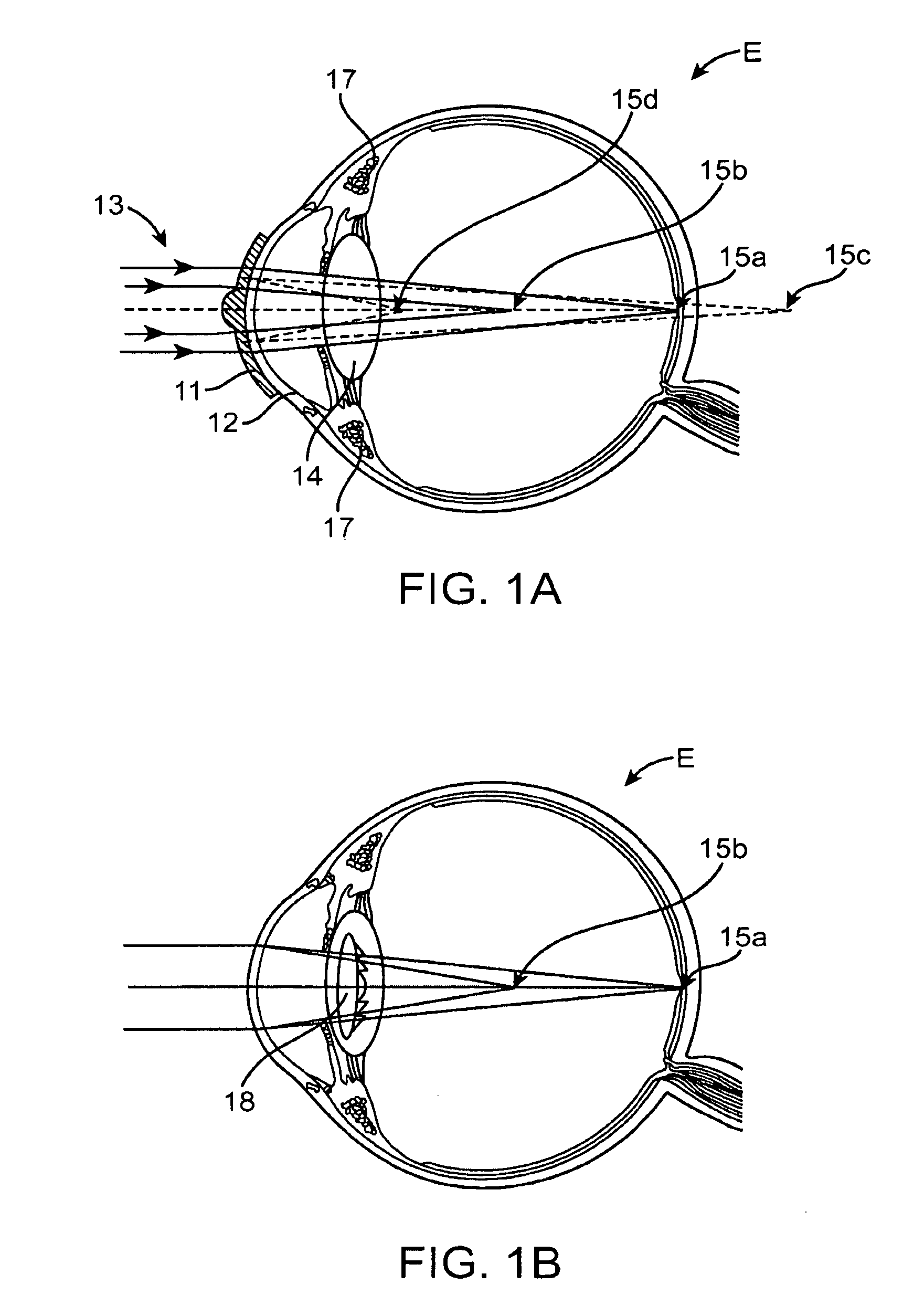 Diffractive lens exhibiting enhanced optical performance