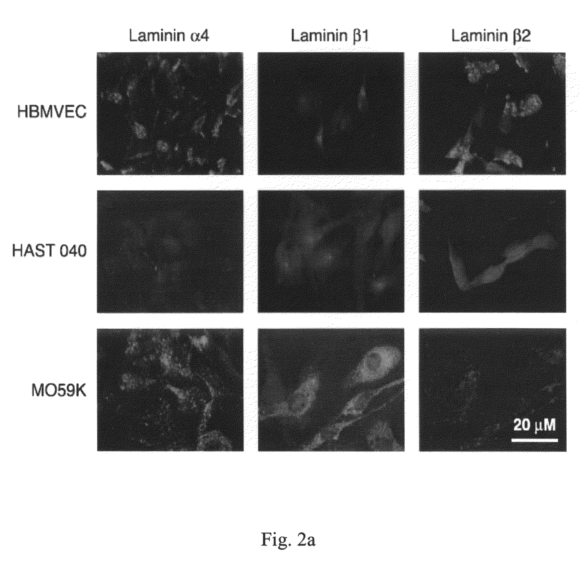 Antisense inhibition of laminin-8 expression to inhibit human gliomas