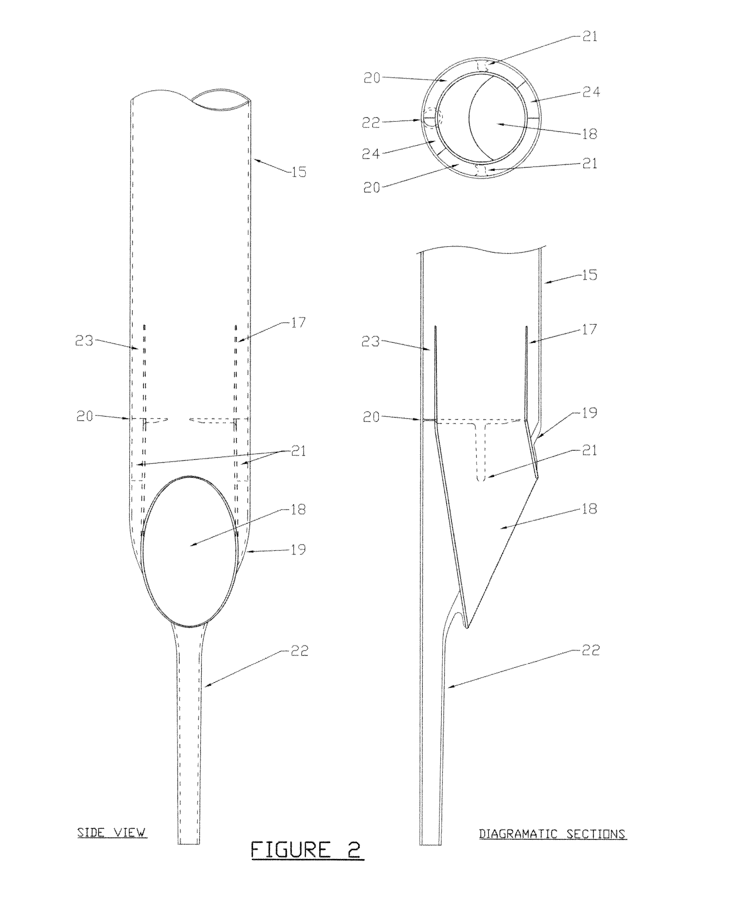 Apparatus for separation and processing of materials