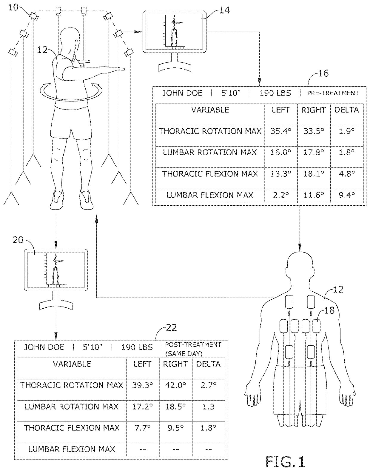 Method of increasing thoracic rotation range of motion