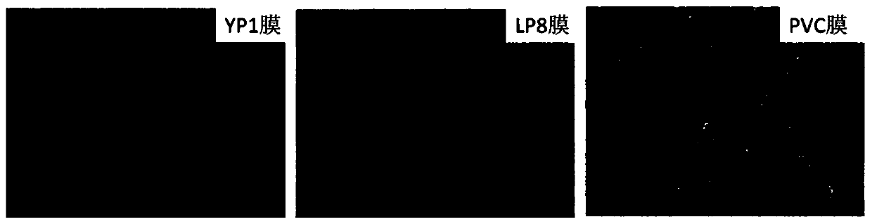 Tertiary amine derivative type chlorine-containing amphiphilic polymer and separation membrane prepared from tertiary amine derivative type chlorine-containing amphiphilic polymer