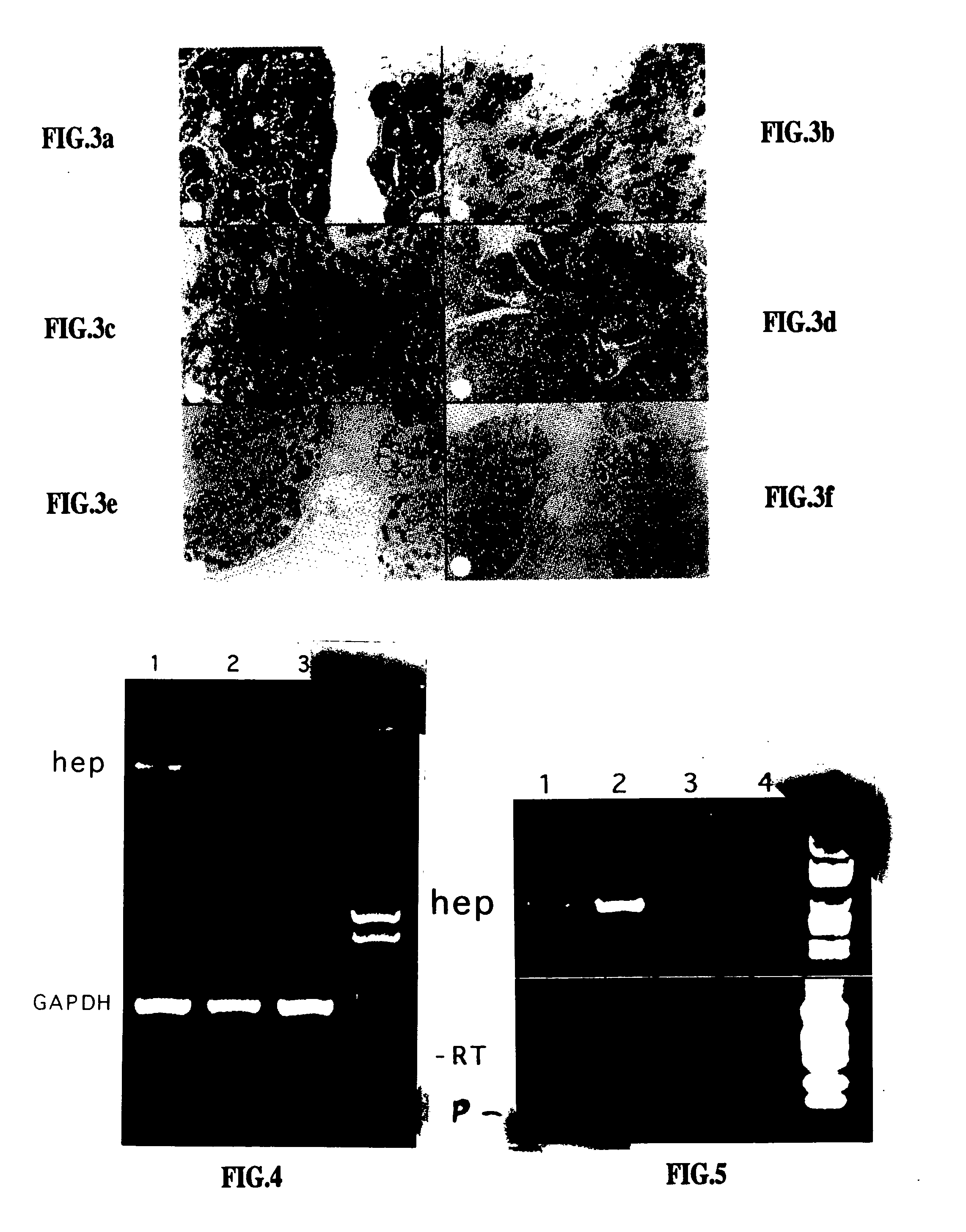 Heparanase specific molecular probes and their use in research and medical applications