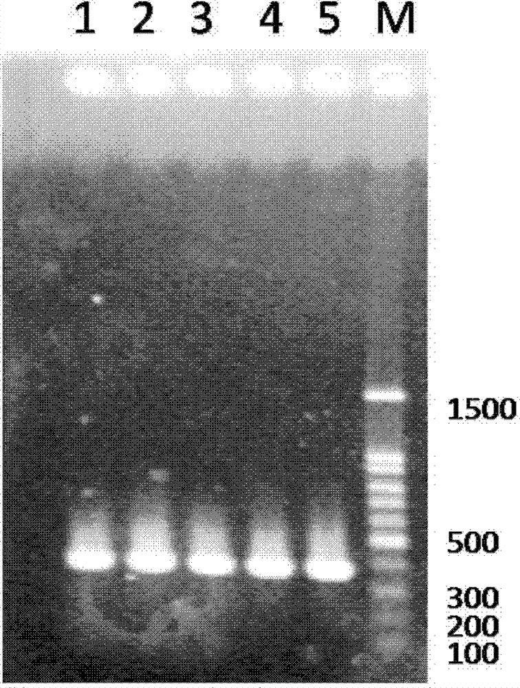 HCV (hepatitis C virus) core antigen and antibody thereof as well as hybridoma cell lines secreting antibody