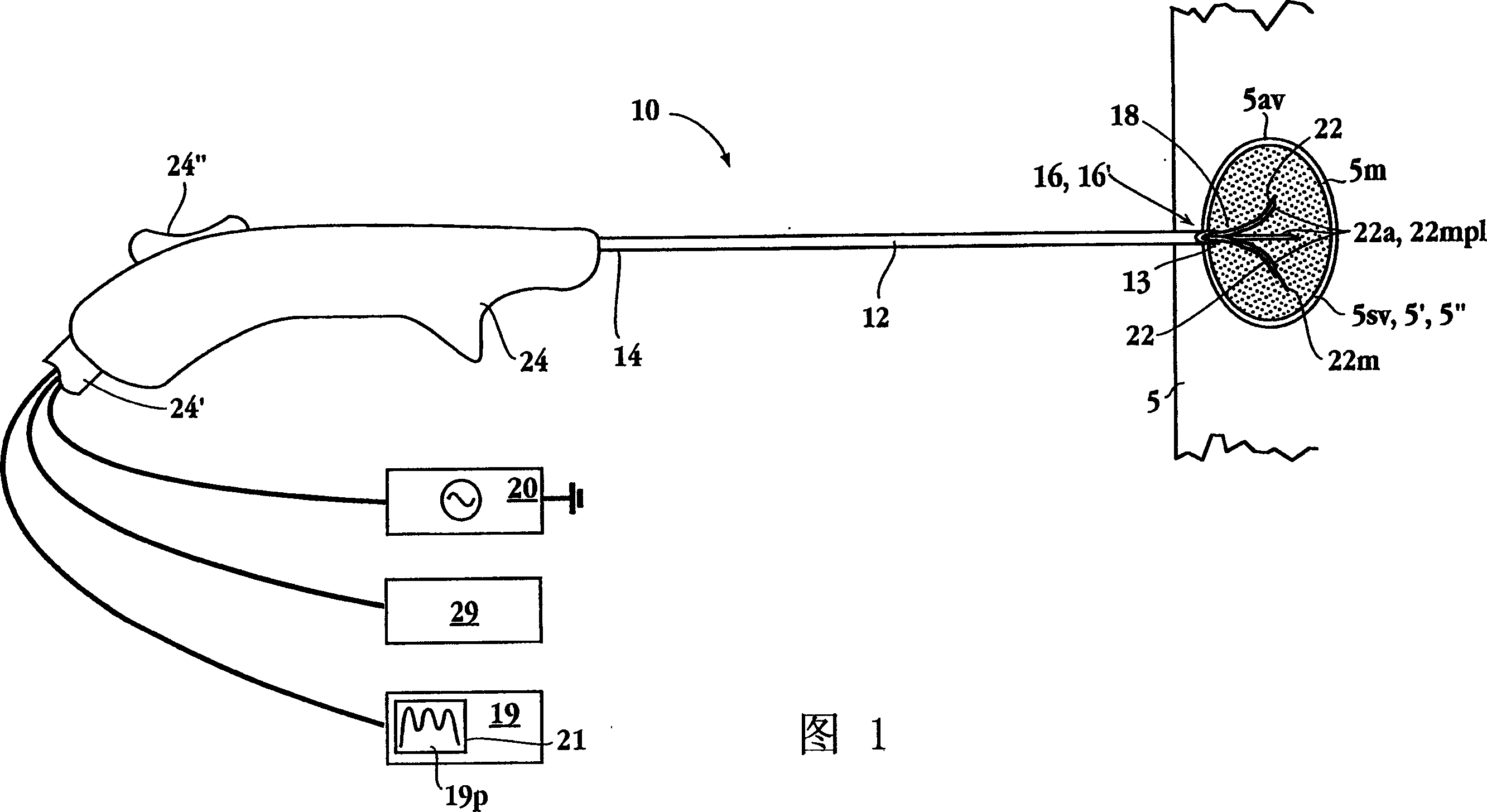 Impedance controlled tissue ablation apparatus and method