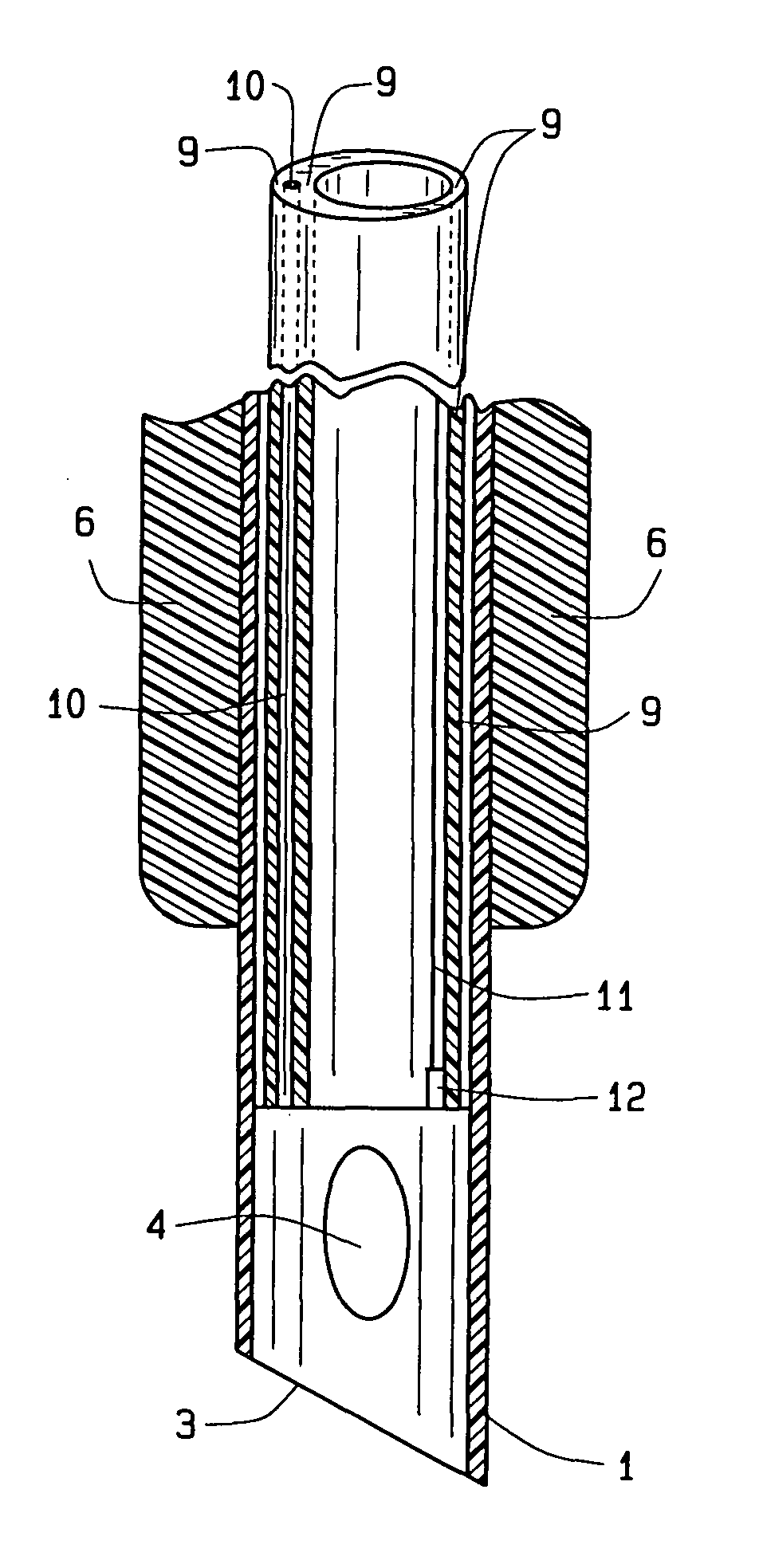 Tubular device delivering light and radiation into a patient