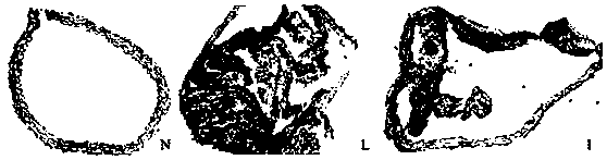 Reagent or kit for evaluating intestinal lipid accumulation and its intervention, and application and detection method thereof