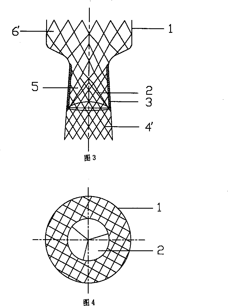 Device for replacing aortic valve membrane or pulmonary valve membrane percutaneously