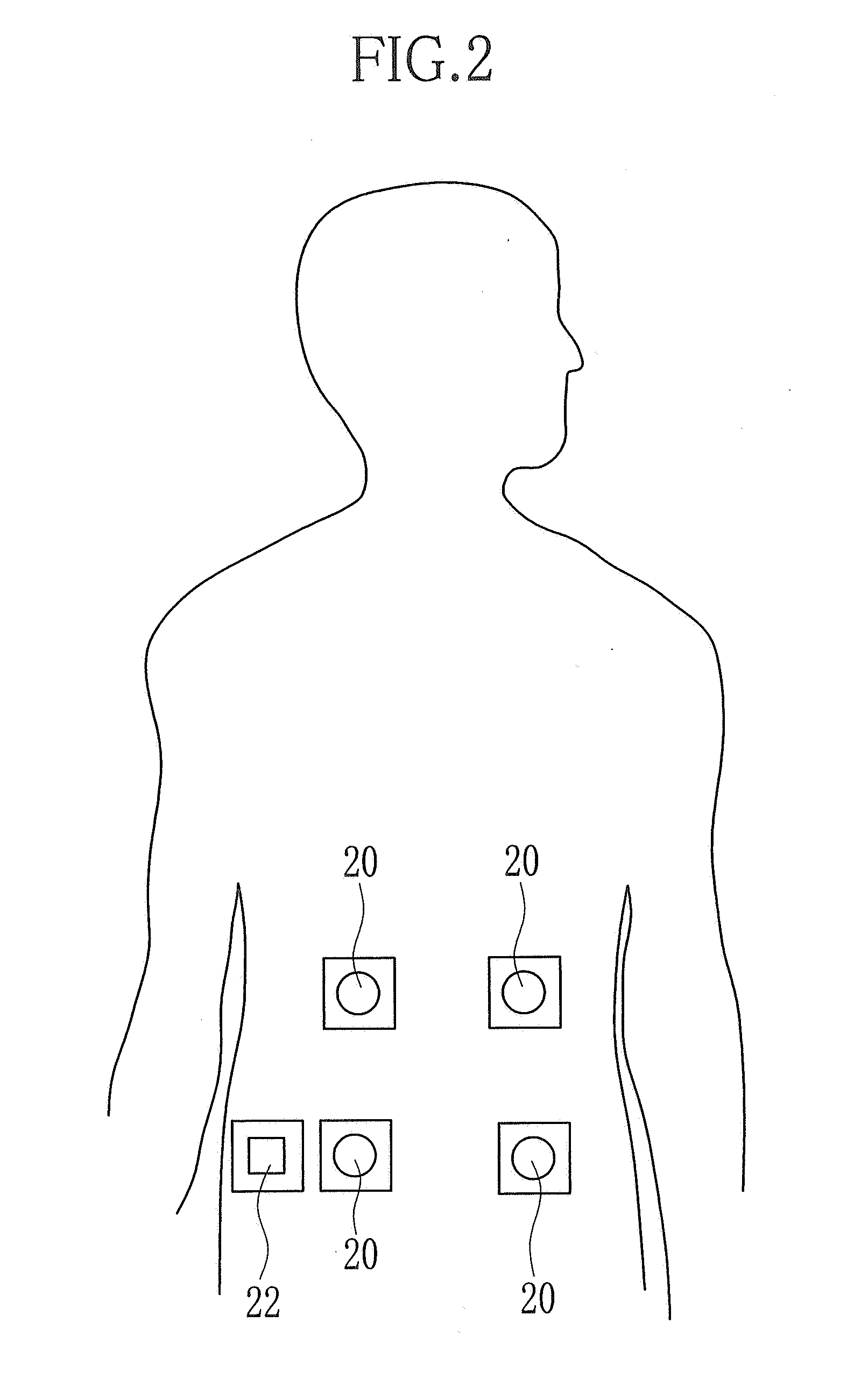 Capsule endoscope