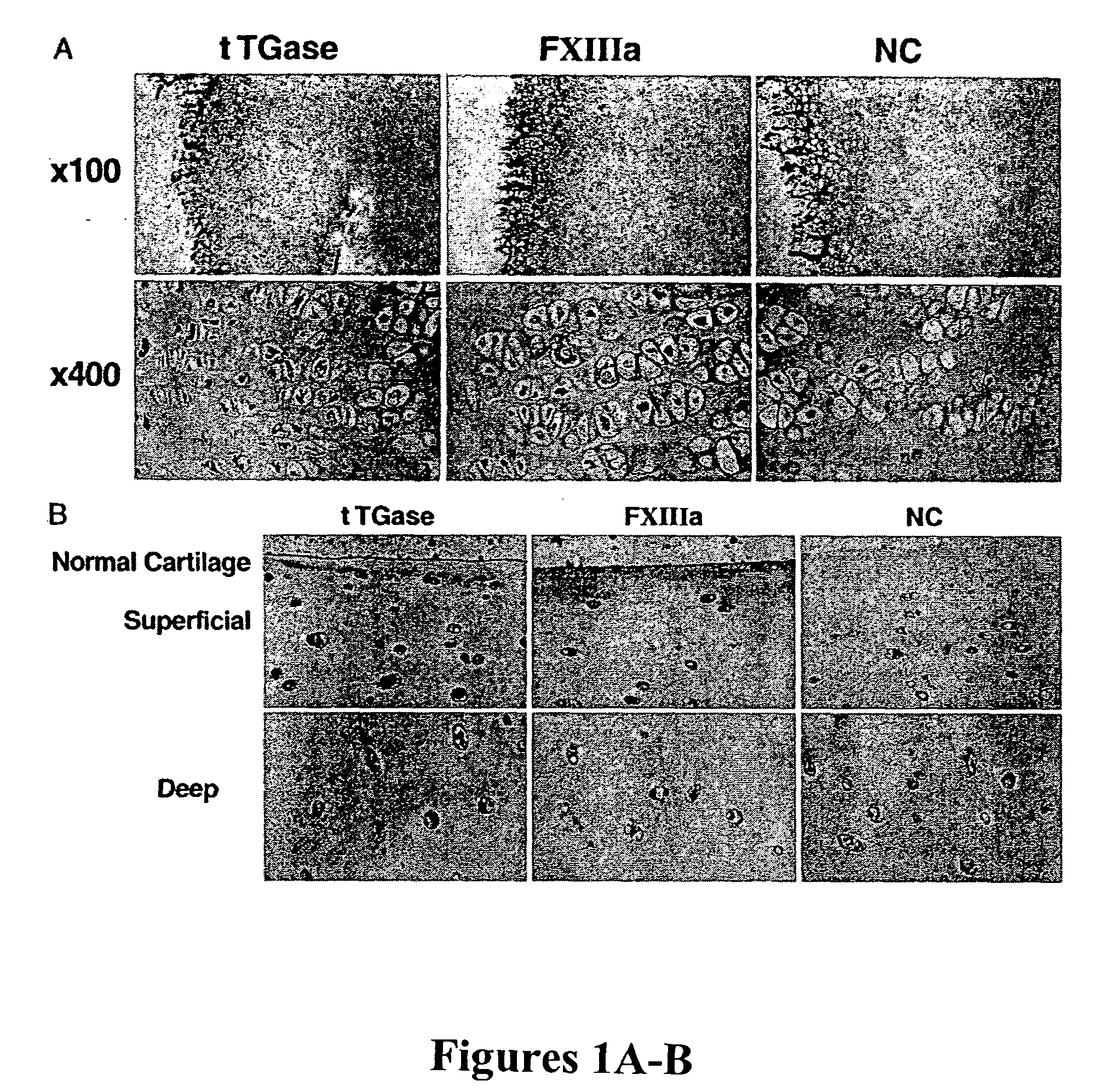 Method for inhibiting articular cartilage matrix calcification