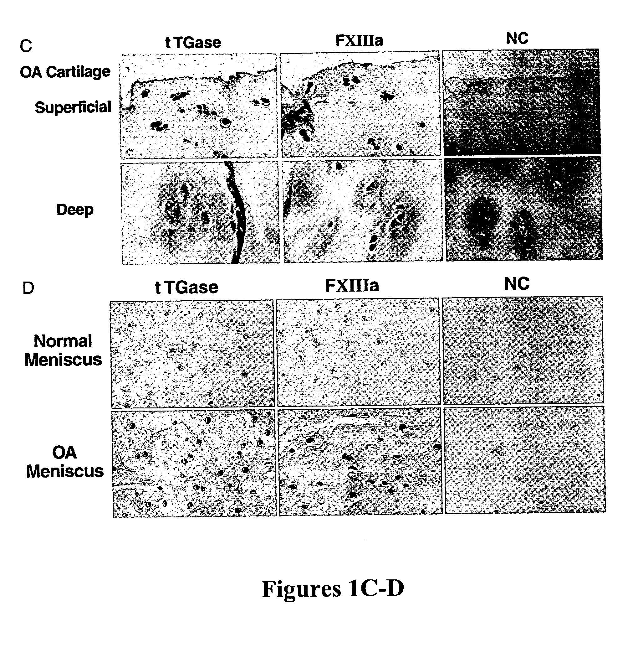 Method for inhibiting articular cartilage matrix calcification