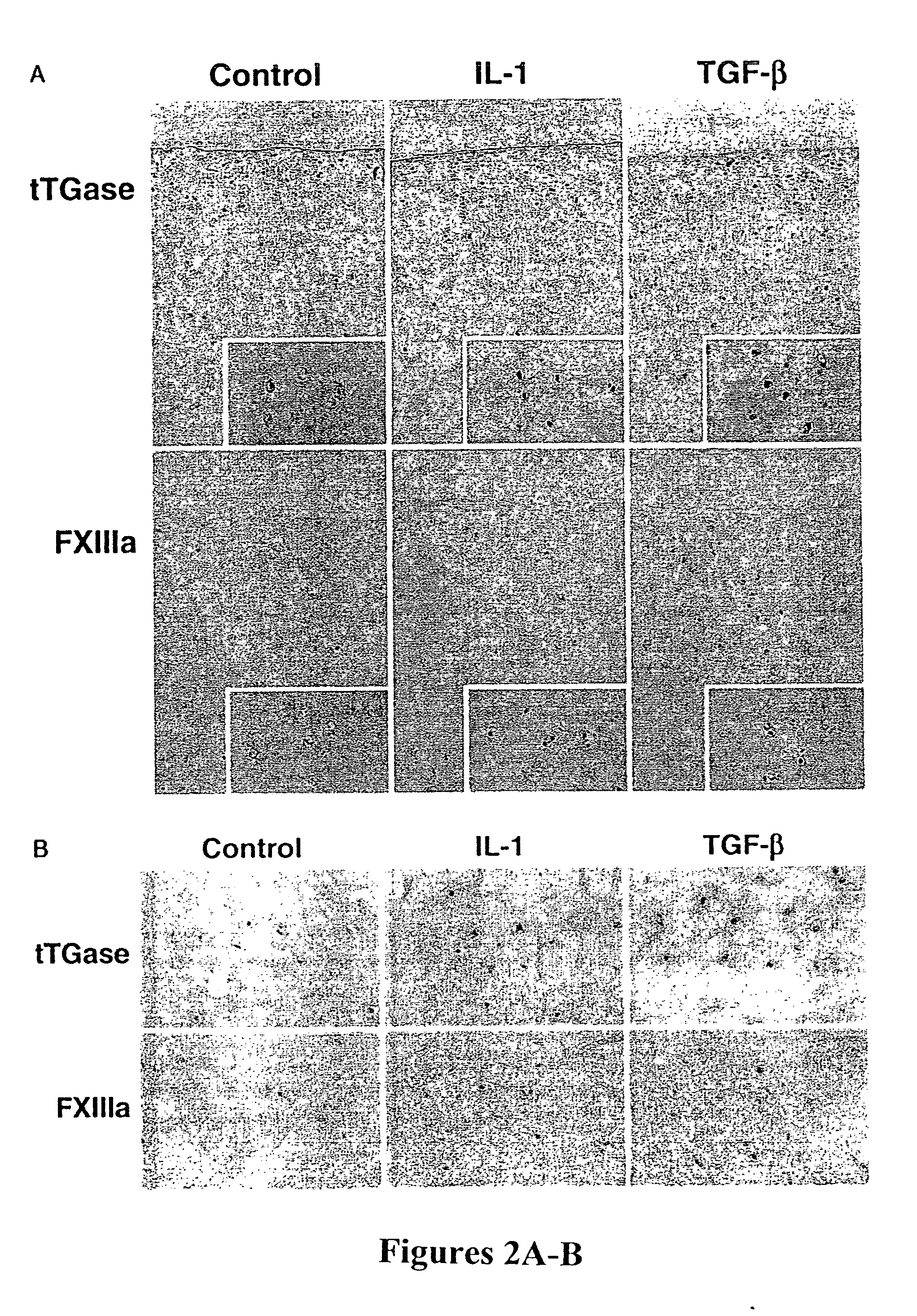 Method for inhibiting articular cartilage matrix calcification