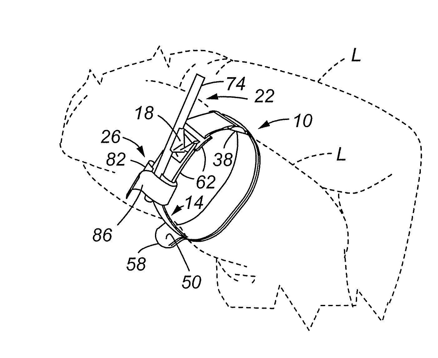 Training tourniquet and method of use