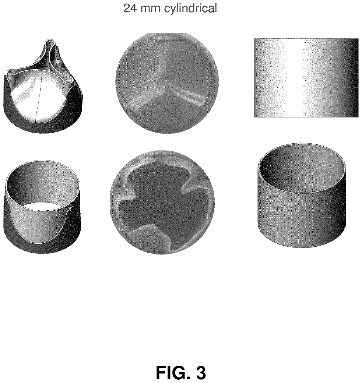 Electrospun Heart Valves