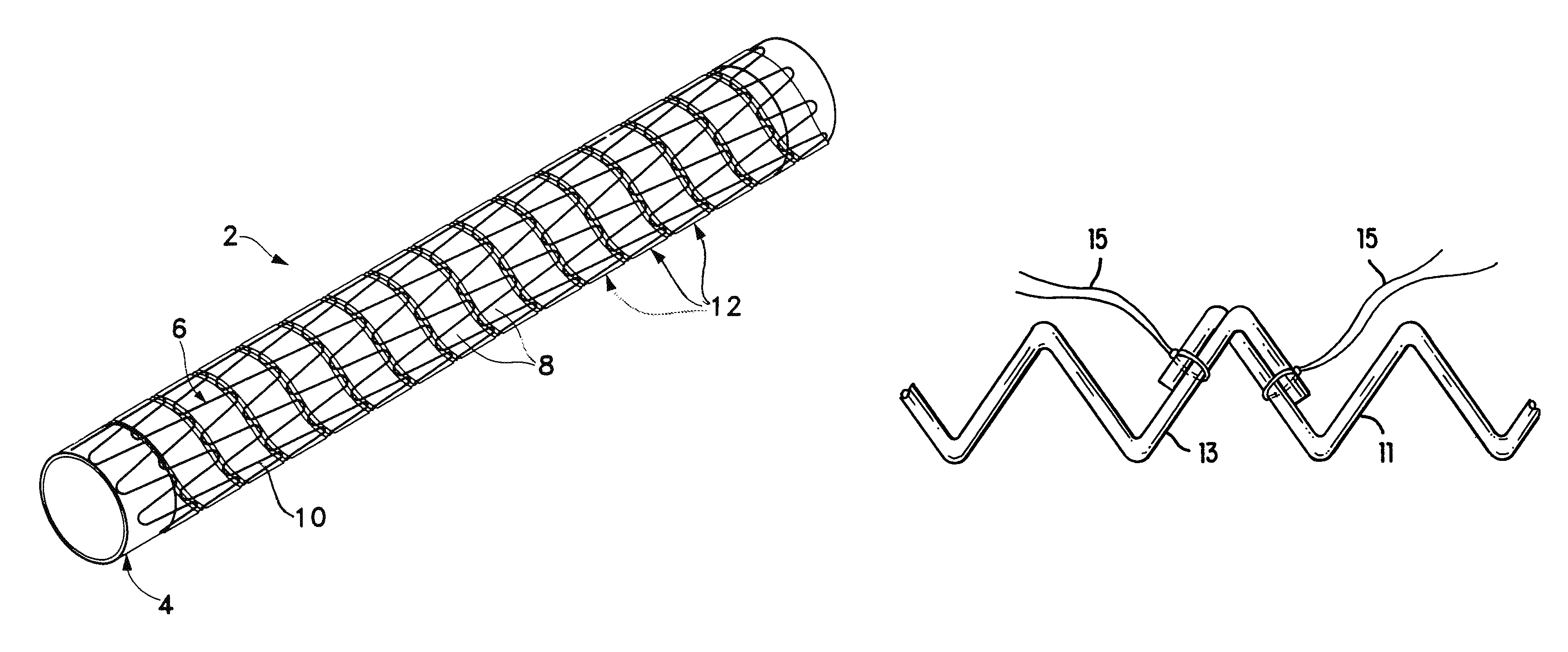 Kink resistant stent-graft