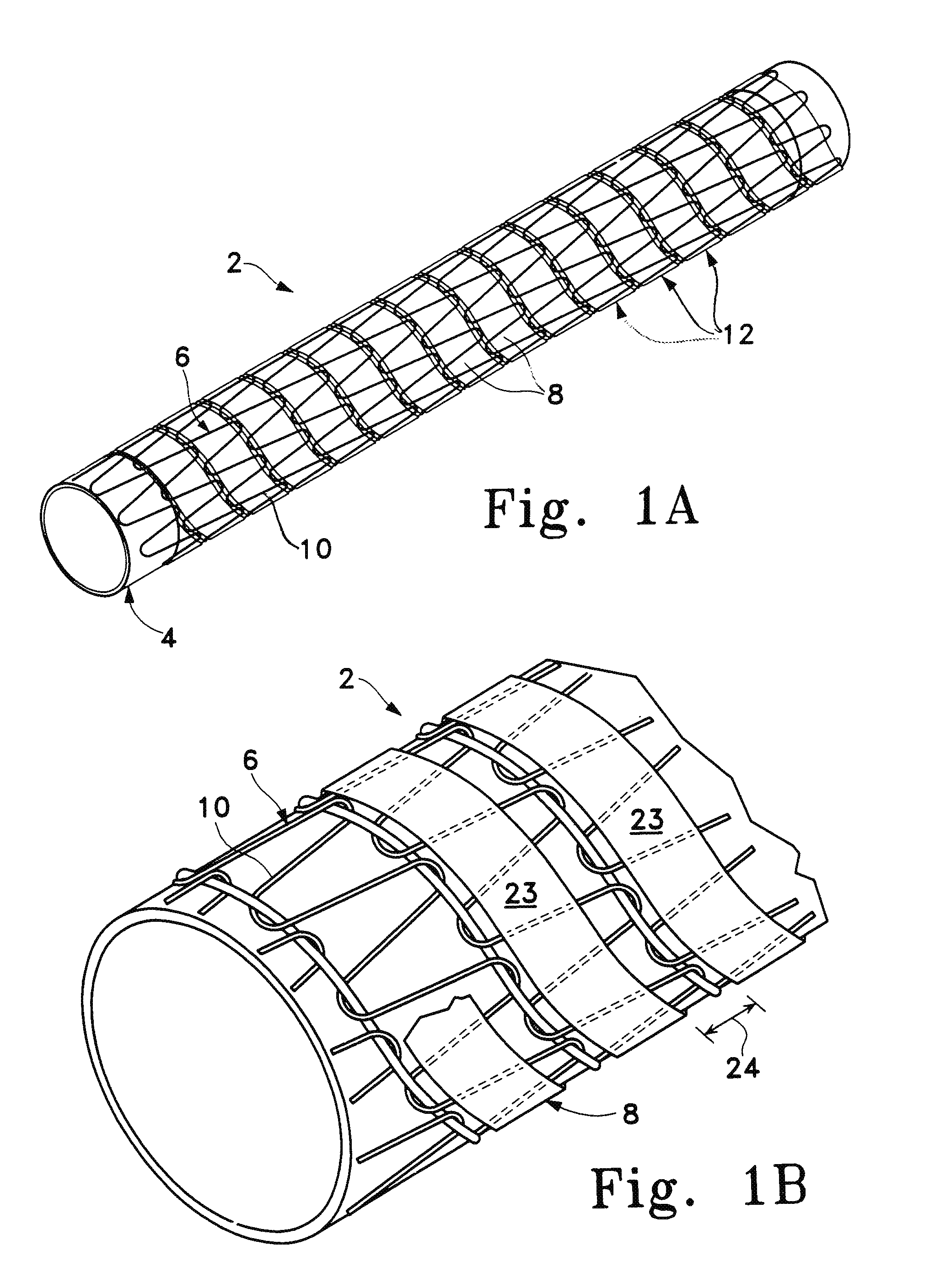 Kink resistant stent-graft