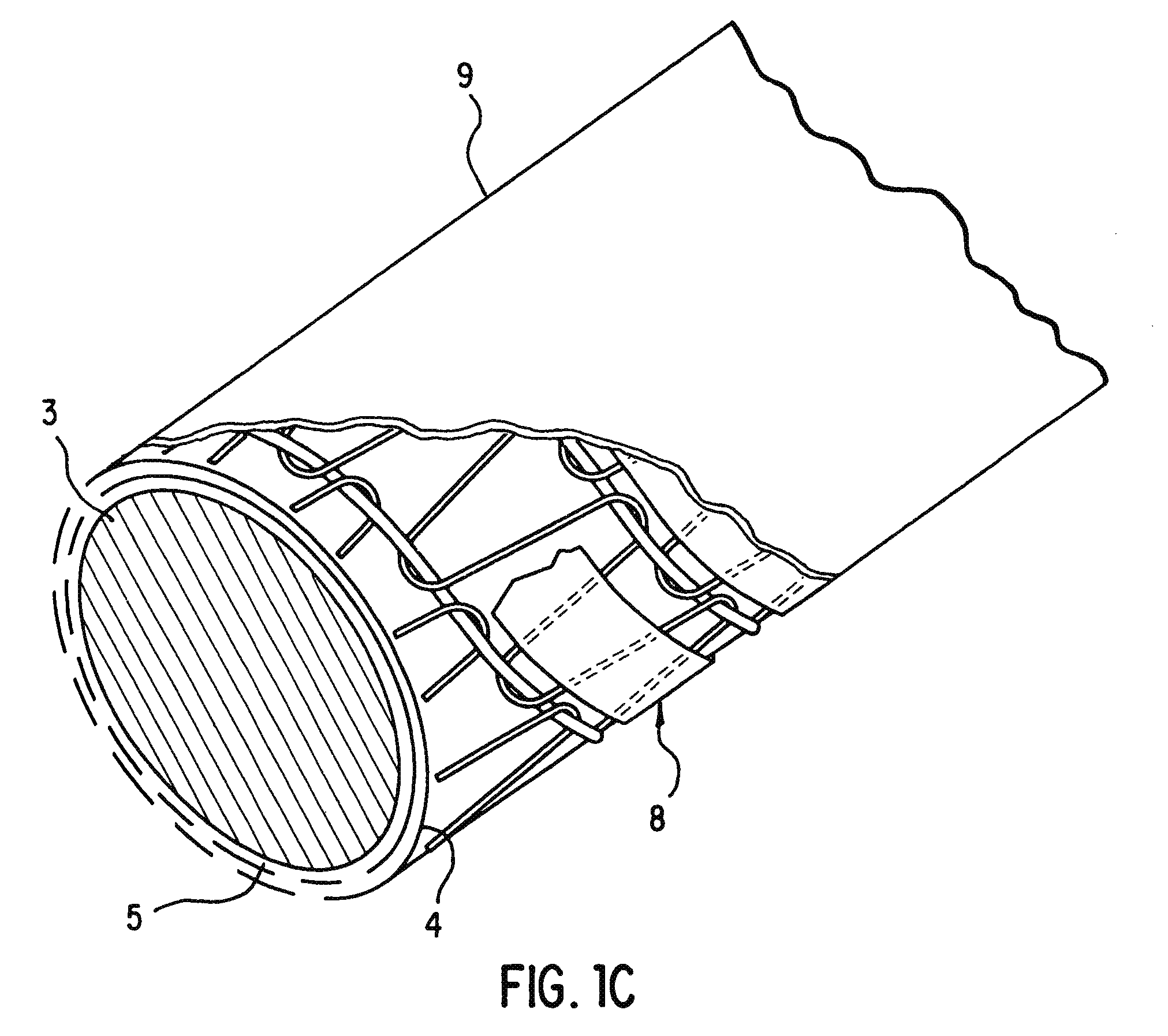 Kink resistant stent-graft