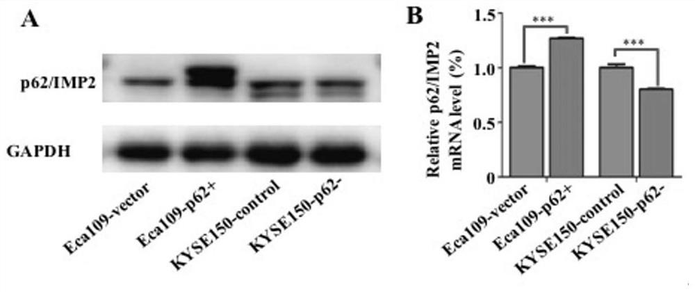 Method for researching influence of tumour-associated antigen p62/IMP2 on esophageal squamous cell carcinoma ESCC