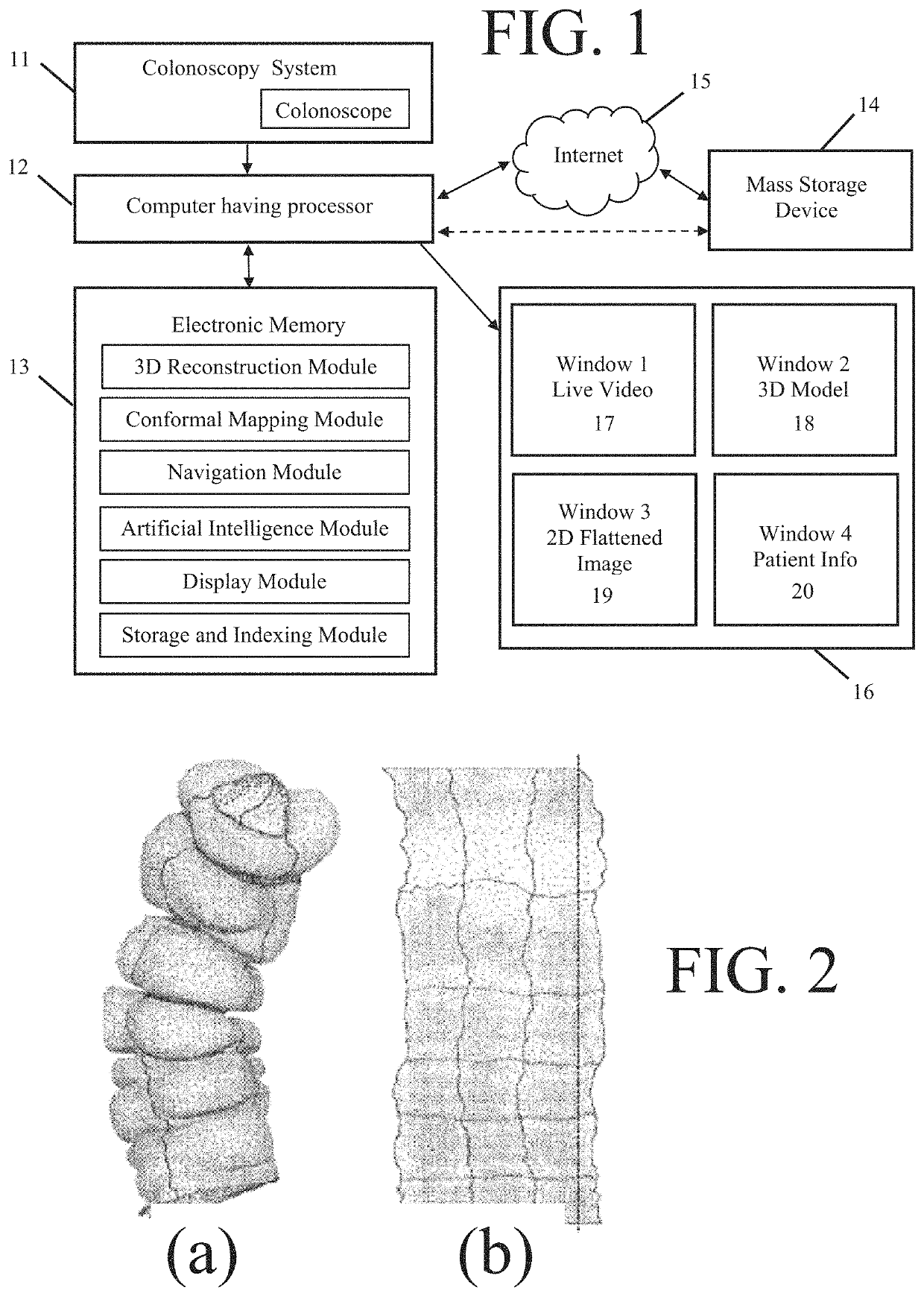 Endoscopic system and methods having real-time medical imaging