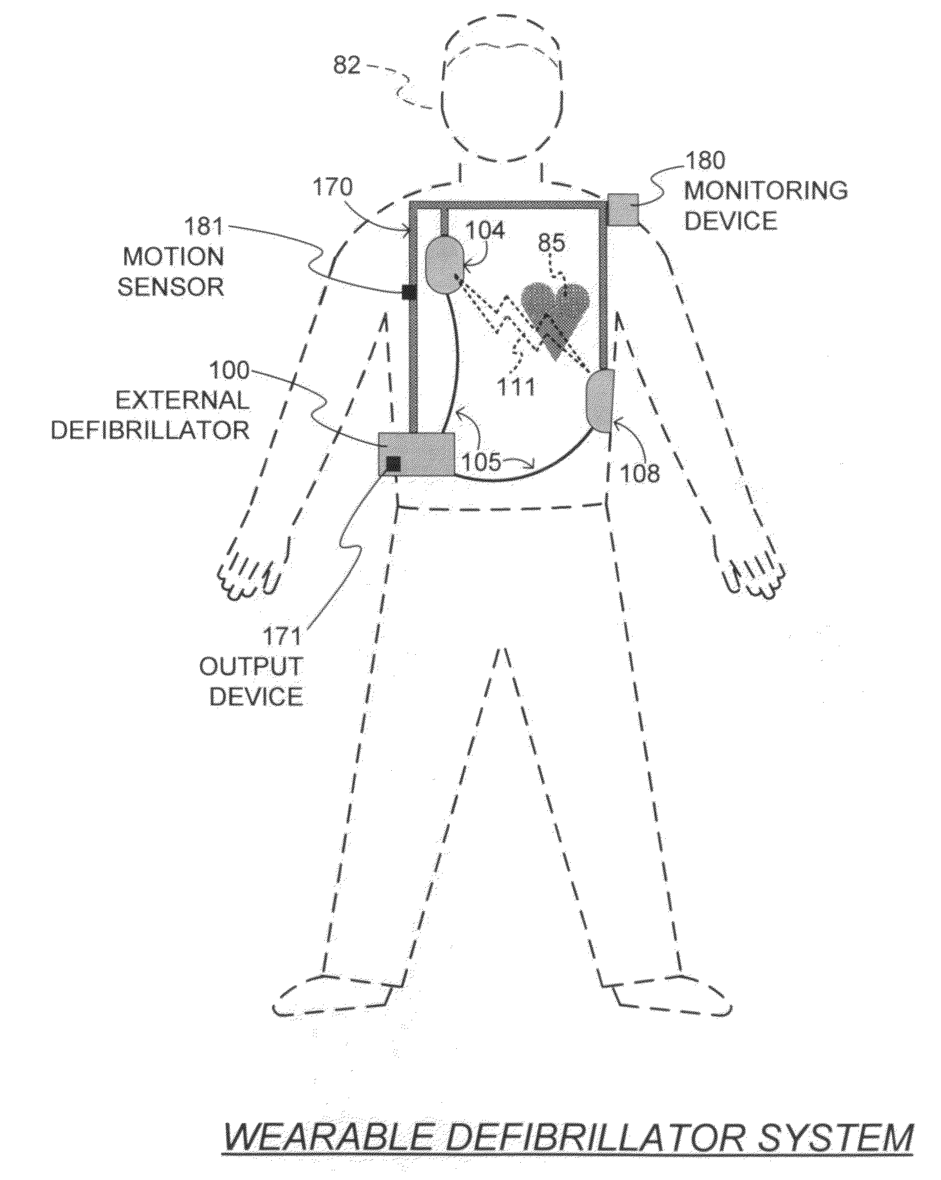 Wearable cardiac defibrillator receiving inputs by being deliberately tapped and methods