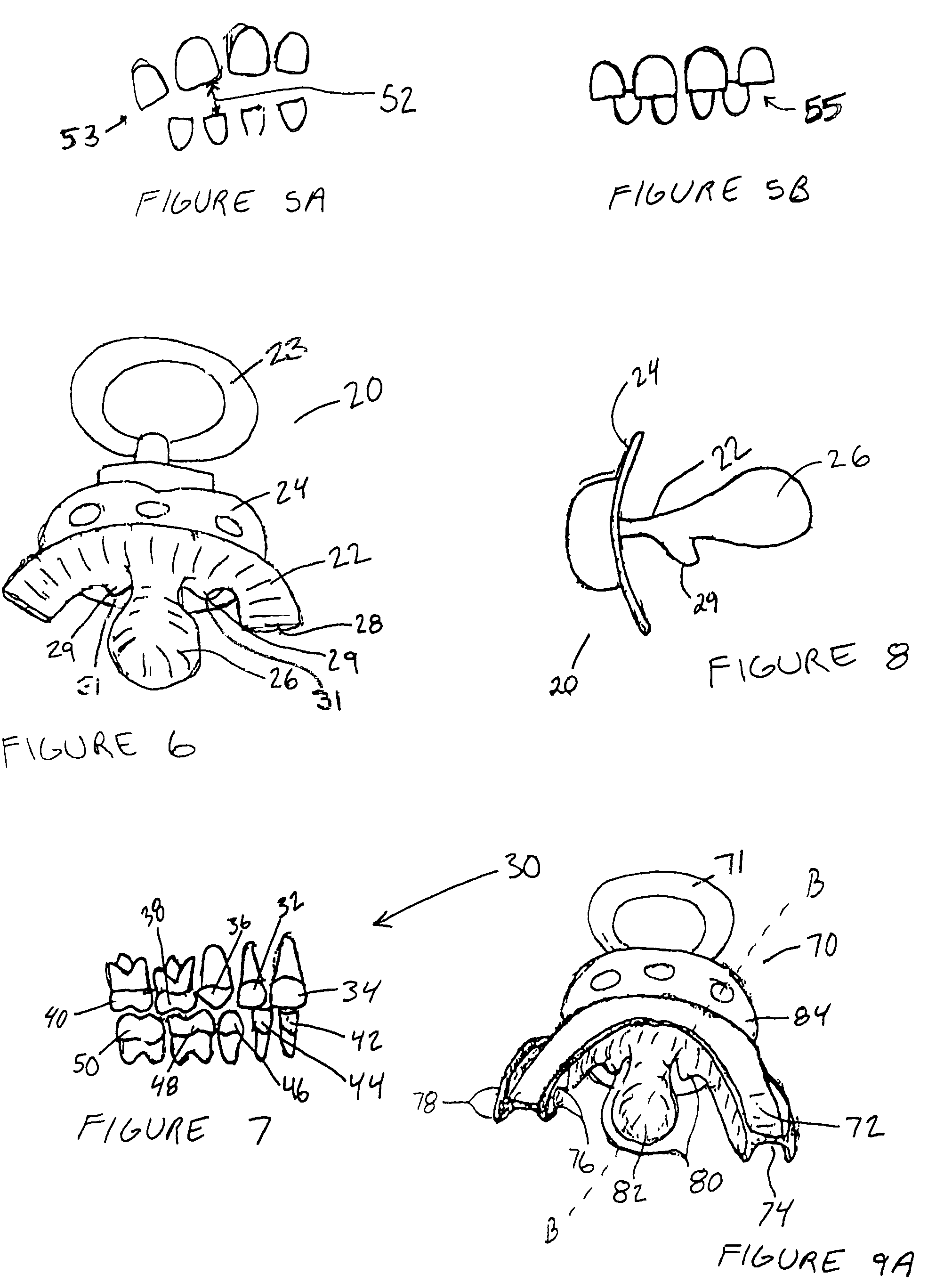 Pacifier, a system and a method for maintaining proper dentitions