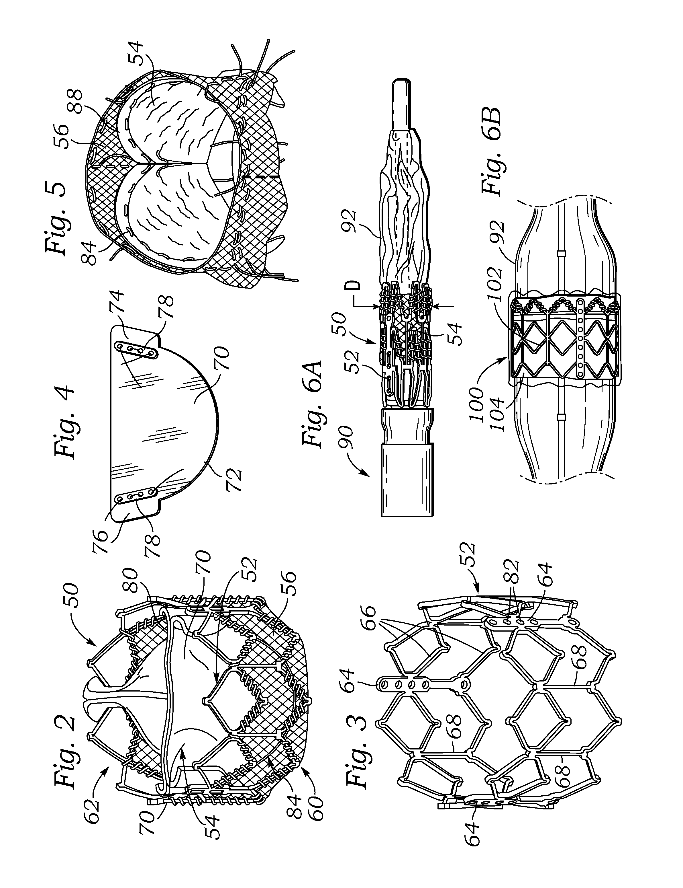 Methods of conditioning sheet bioprosthetic tissue