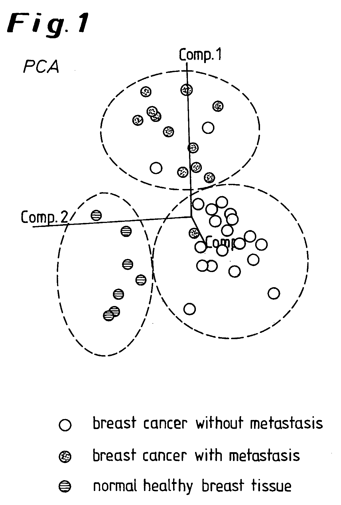 Methods and Kits For the Prediction of Therapeutic Success and Recurrence Free Survival In Cancer Therapy