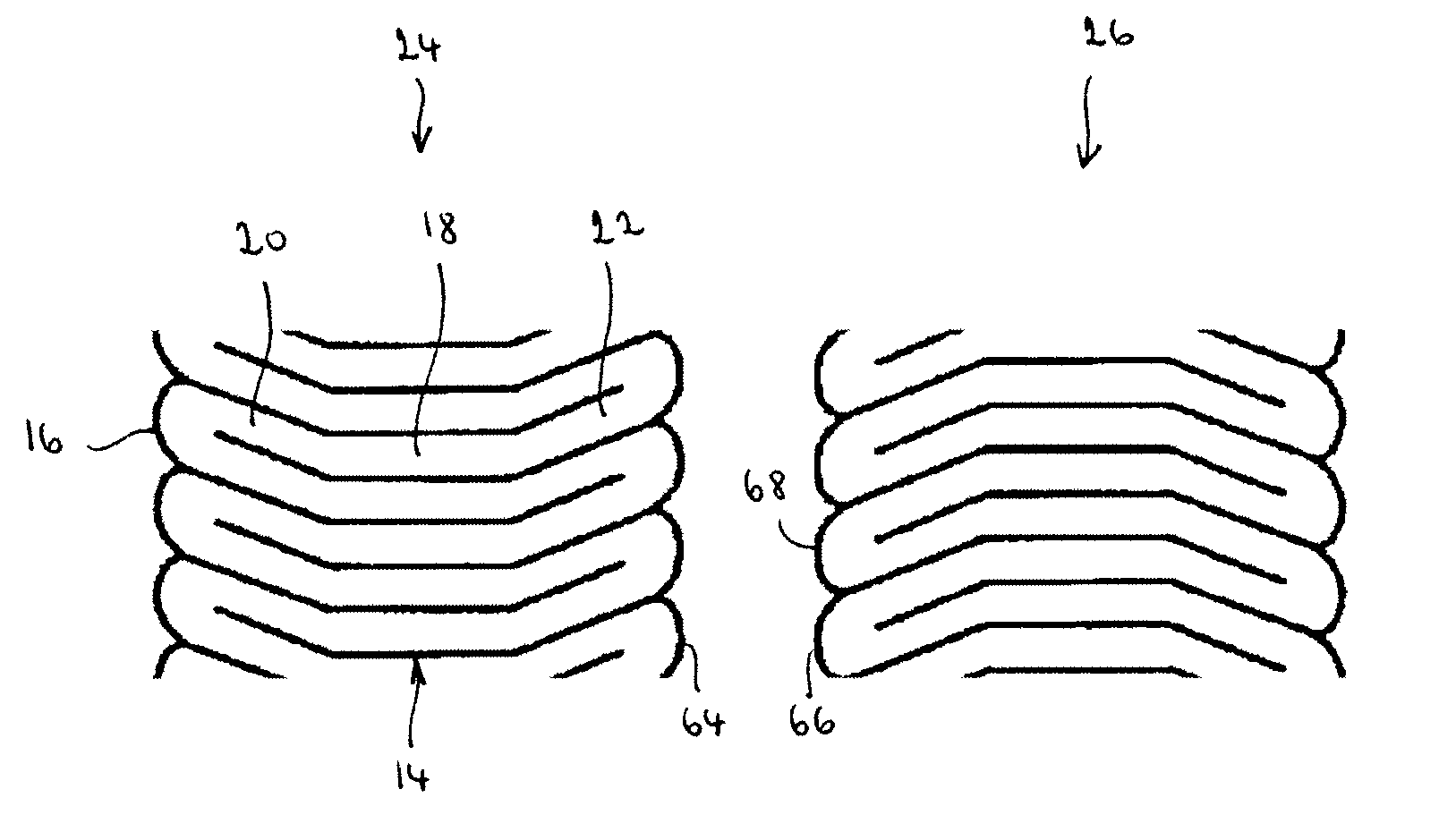 Endoprosthesis having rings linked by foot extensions