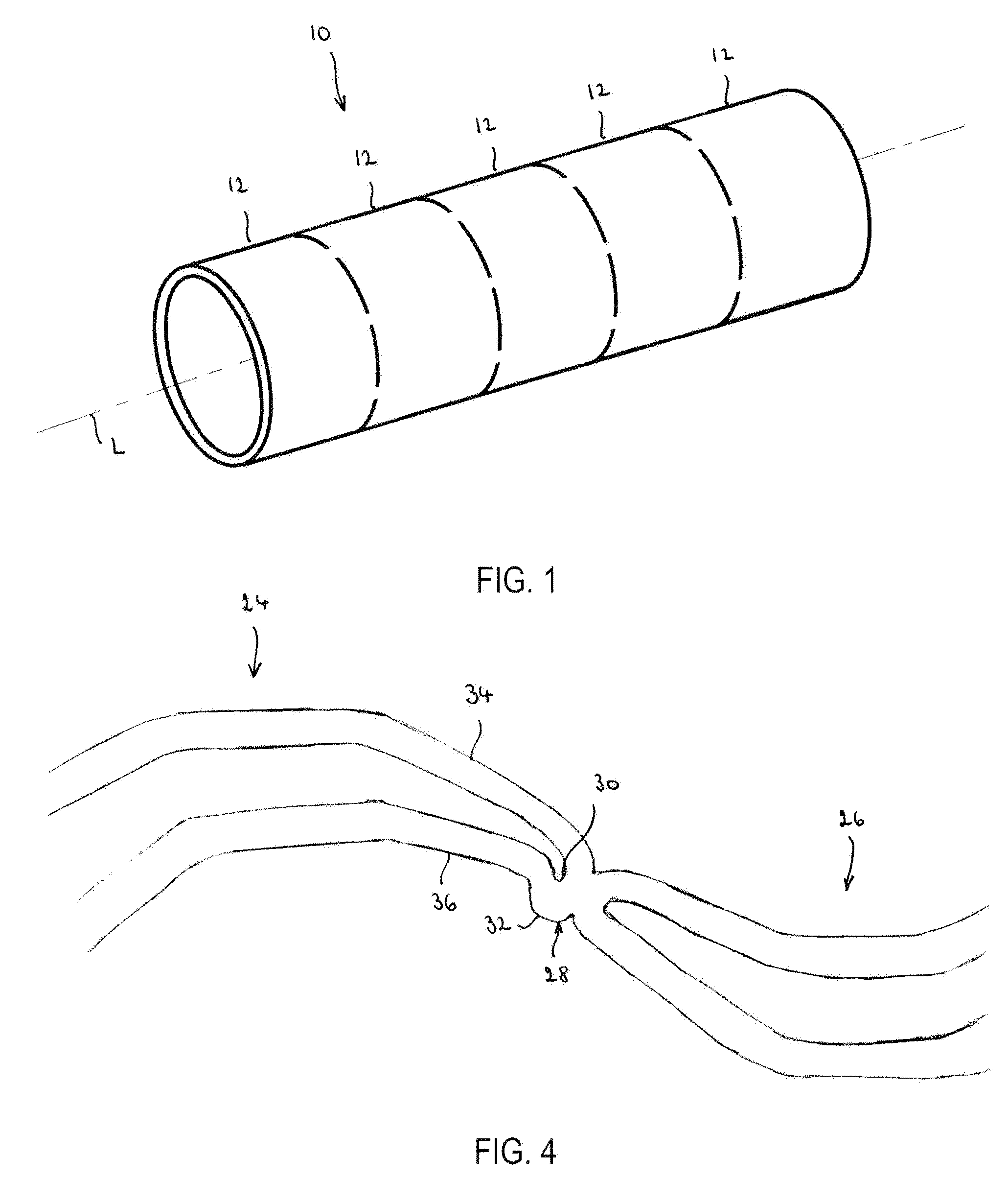 Endoprosthesis having rings linked by foot extensions